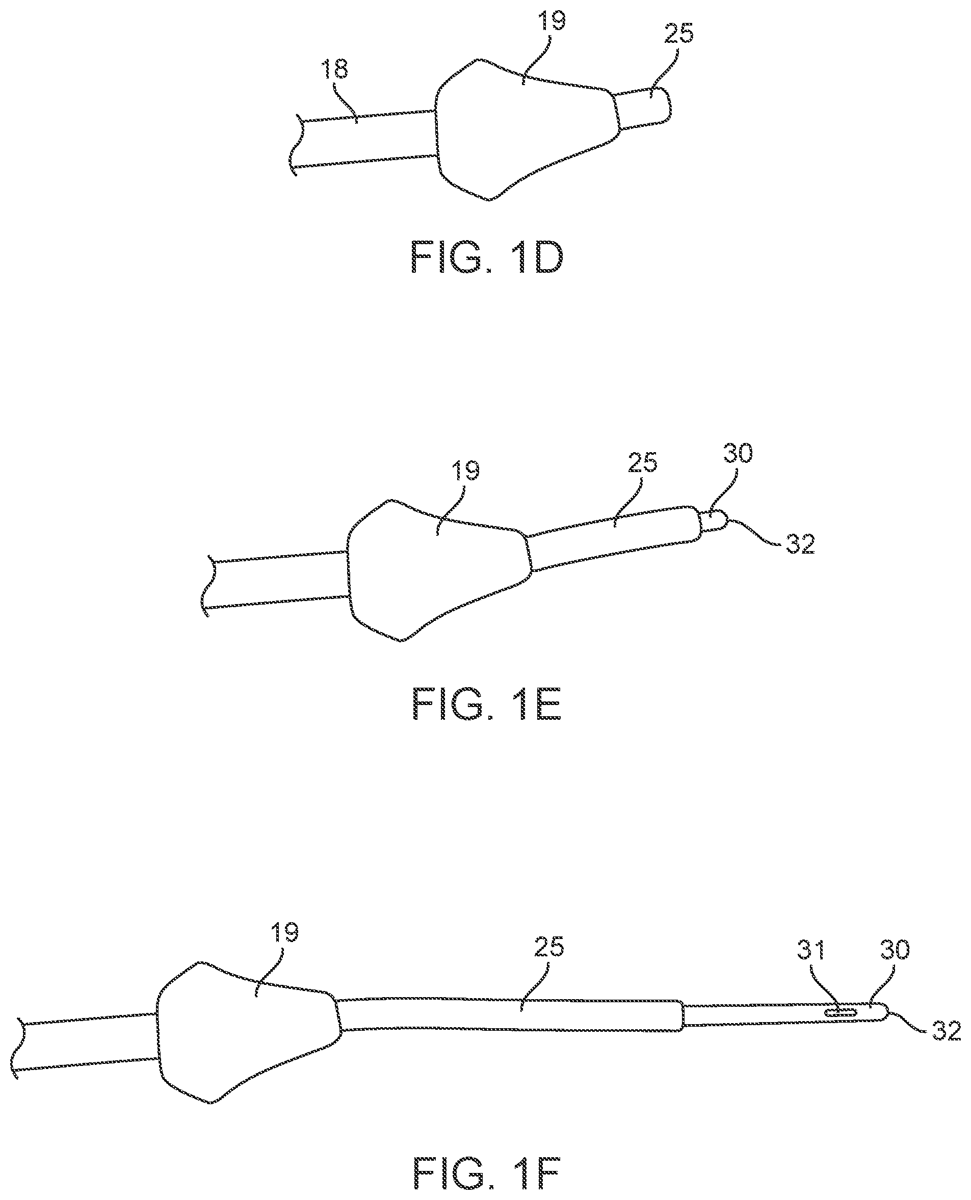 Patent US12311123 Figure 3 – Apparatus and method for everting catheter for uterine access for biopsy and cytology