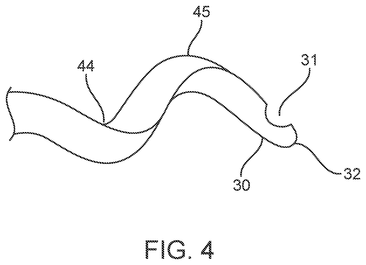 Patent US12311123 Figure 6 – Apparatus and method for everting catheter for uterine access for biopsy and cytology
