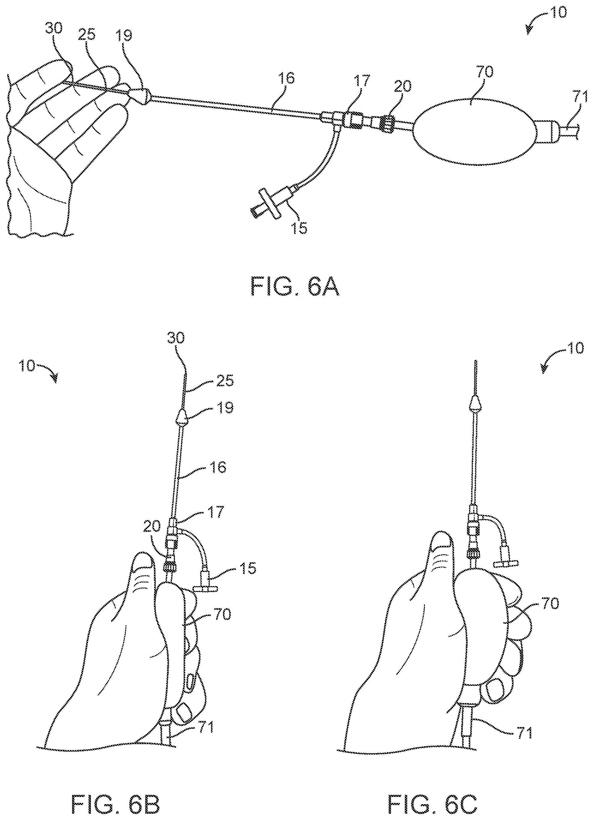 Patent US12311123 Figure 8 – Apparatus and method for everting catheter for uterine access for biopsy and cytology
