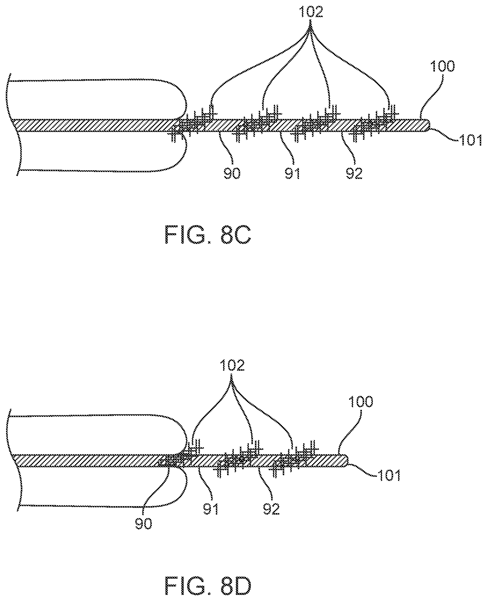 Patent US12311123 Figure 11 – Apparatus and method for everting catheter for uterine access for biopsy and cytology