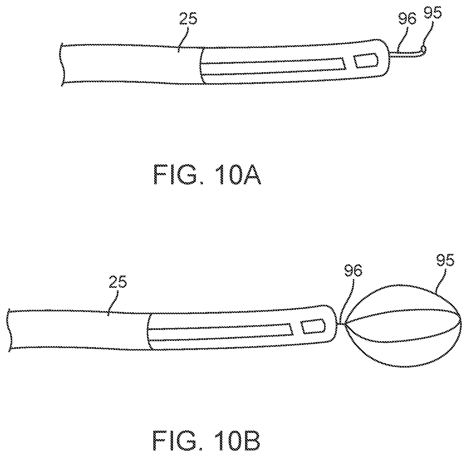 Patent US12311123 Figure 14 – Apparatus and method for everting catheter for uterine access for biopsy and cytology
