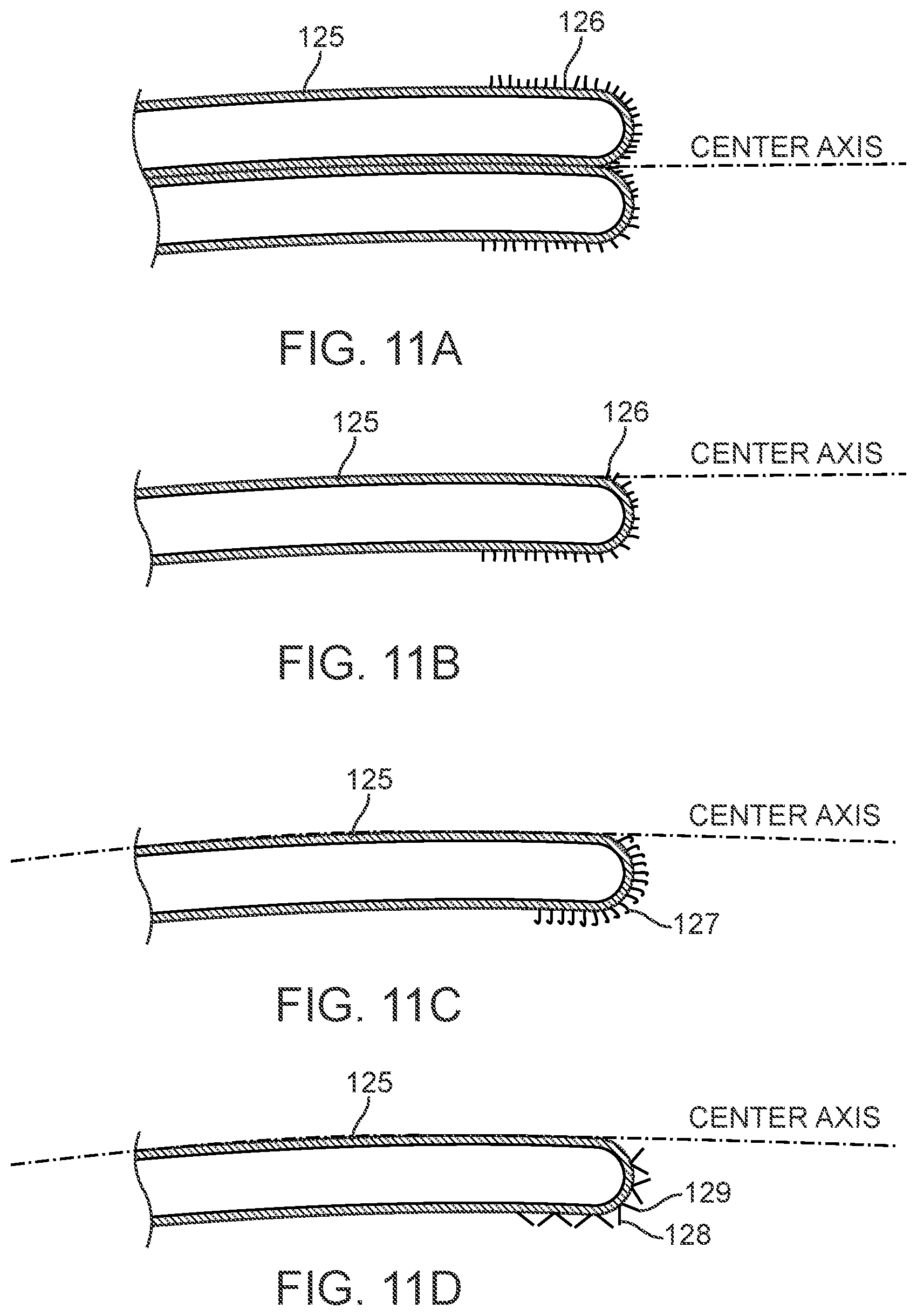 Patent US12311123 Figure 15 – Apparatus and method for everting catheter for uterine access for biopsy and cytology