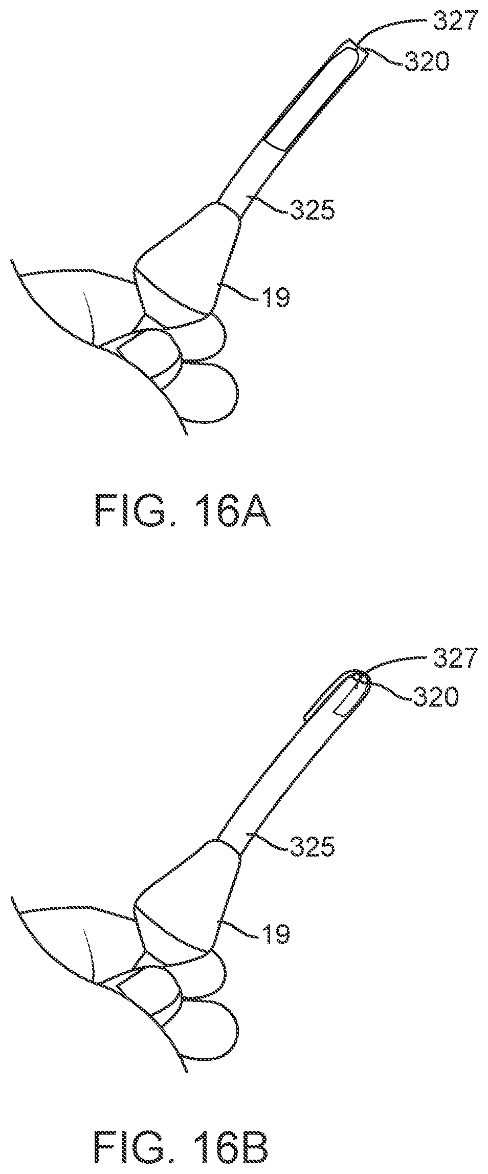 Patent US12311123 Figure 20 – Apparatus and method for everting catheter for uterine access for biopsy and cytology