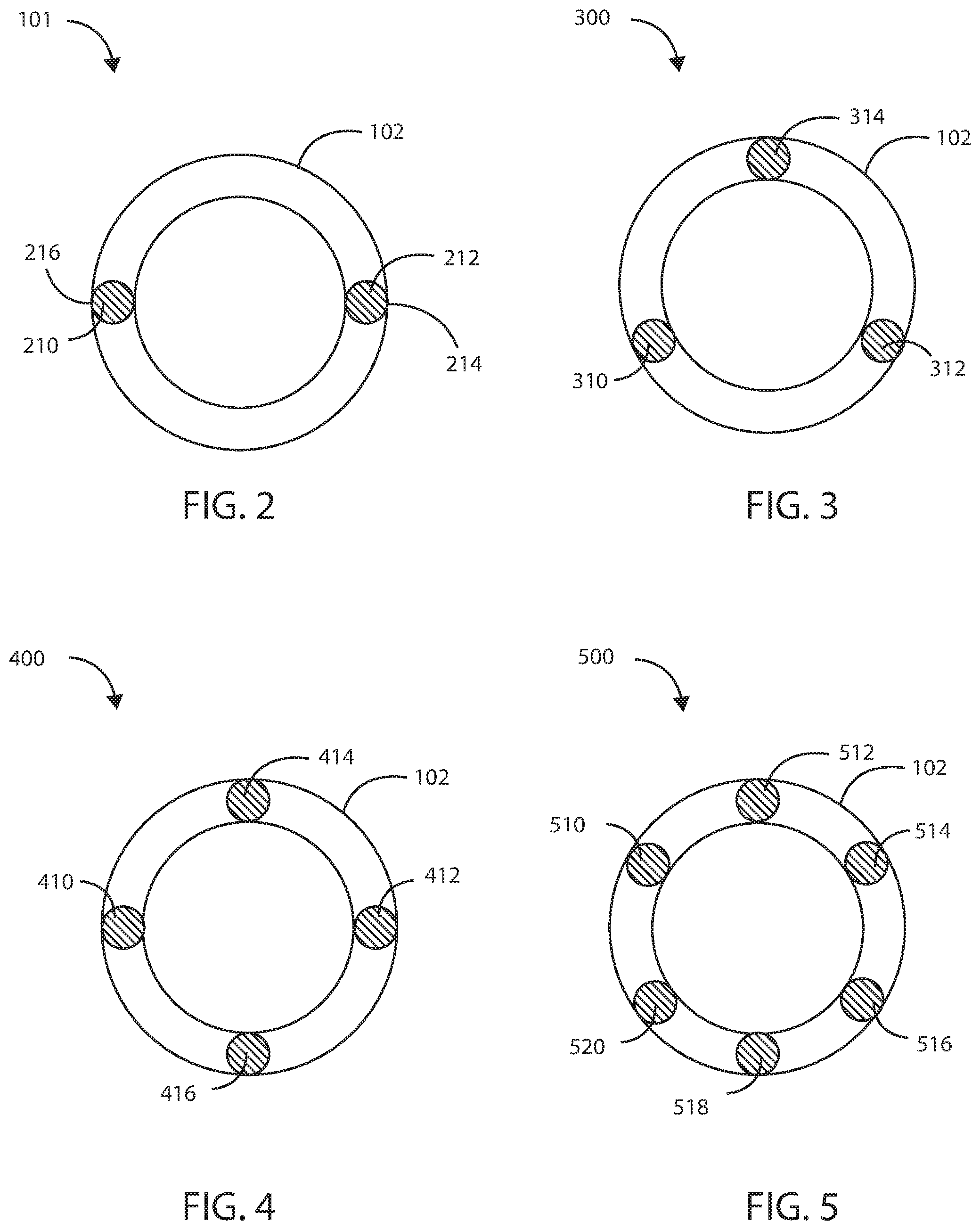 Patent US12311124 Figure 2 – Fortified balloon inflation fluid for plasma system to disrupt vascular lesions