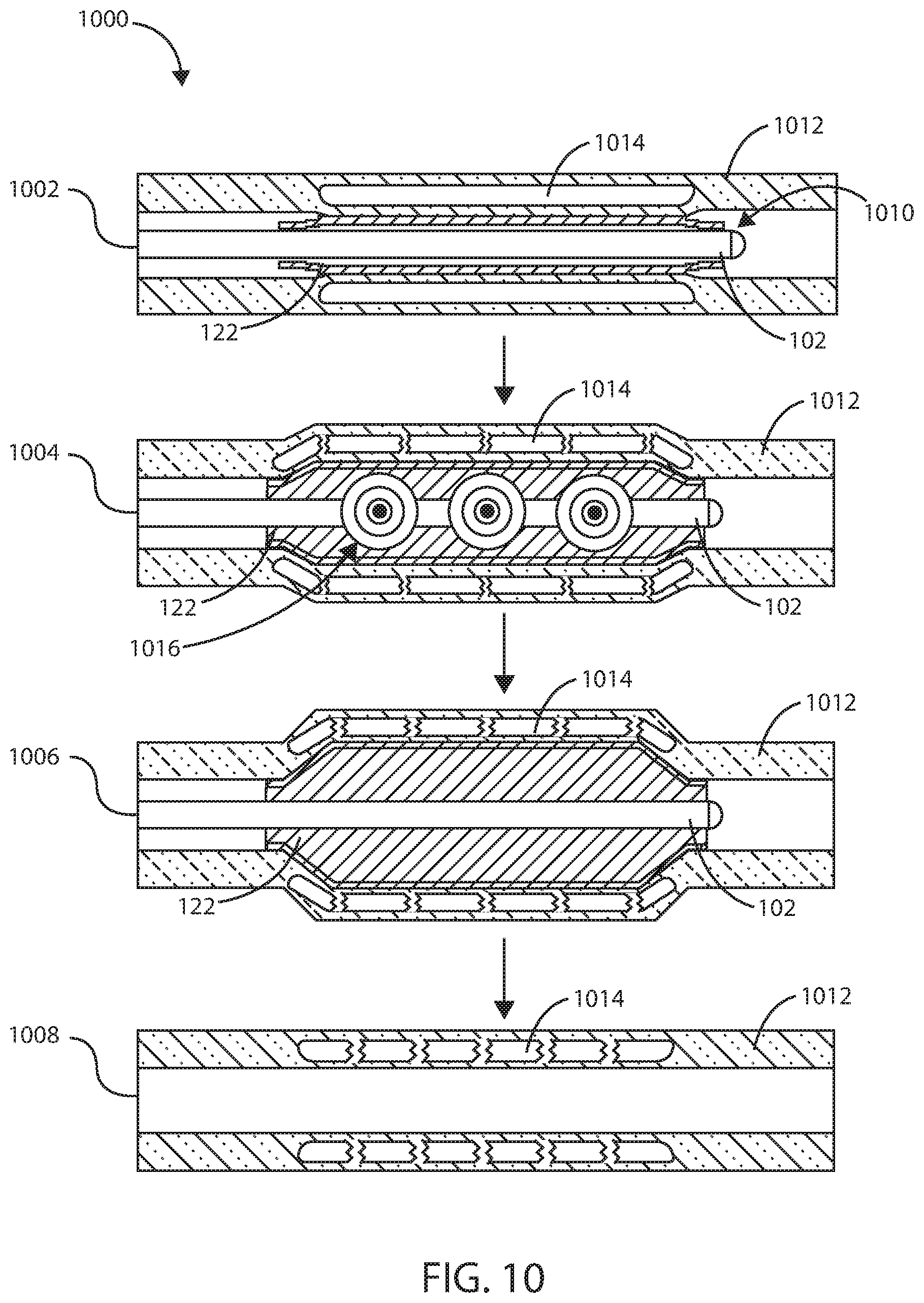 Patent US12311124 Figure 7 – Fortified balloon inflation fluid for plasma system to disrupt vascular lesions