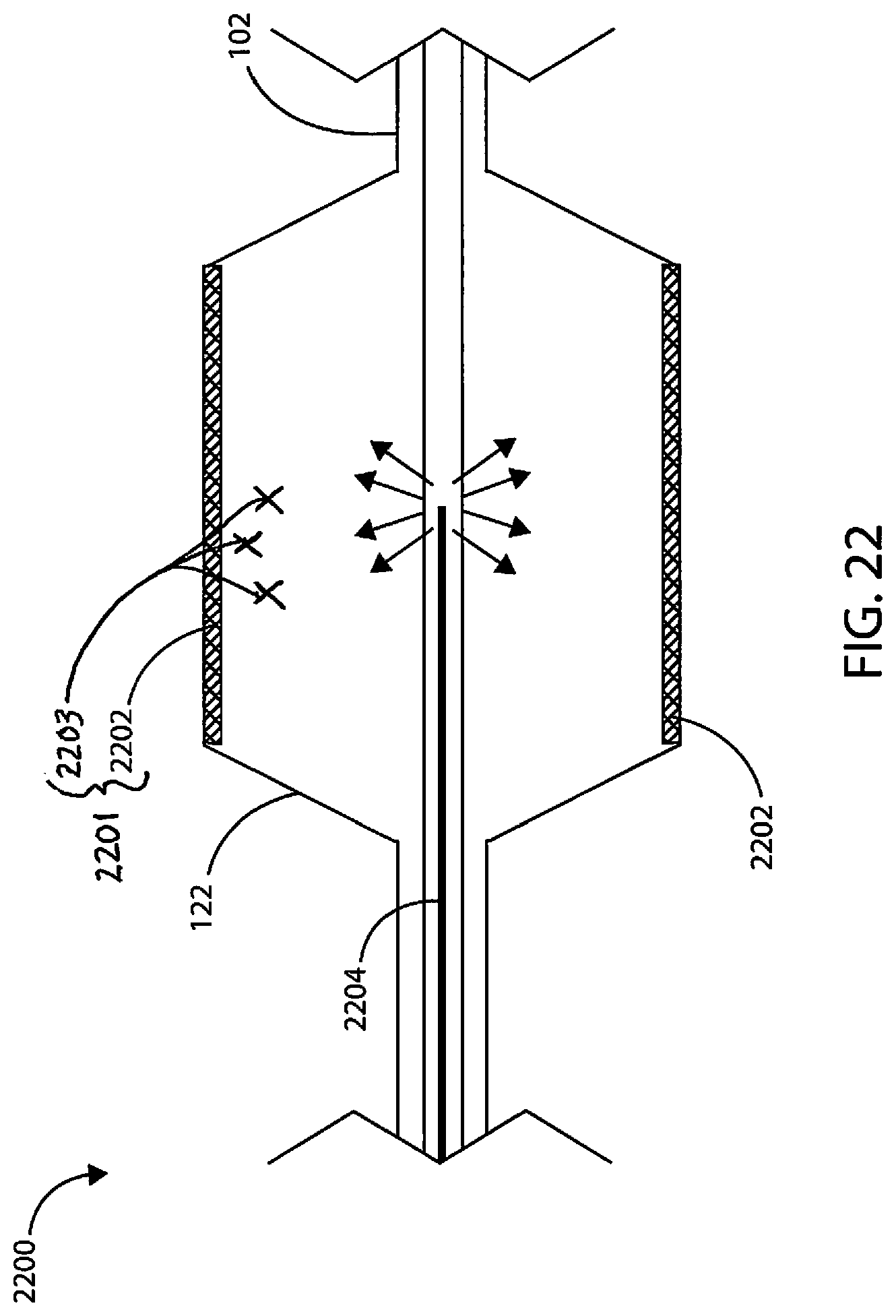 Patent US12311124 Figure 16 – Fortified balloon inflation fluid for plasma system to disrupt vascular lesions