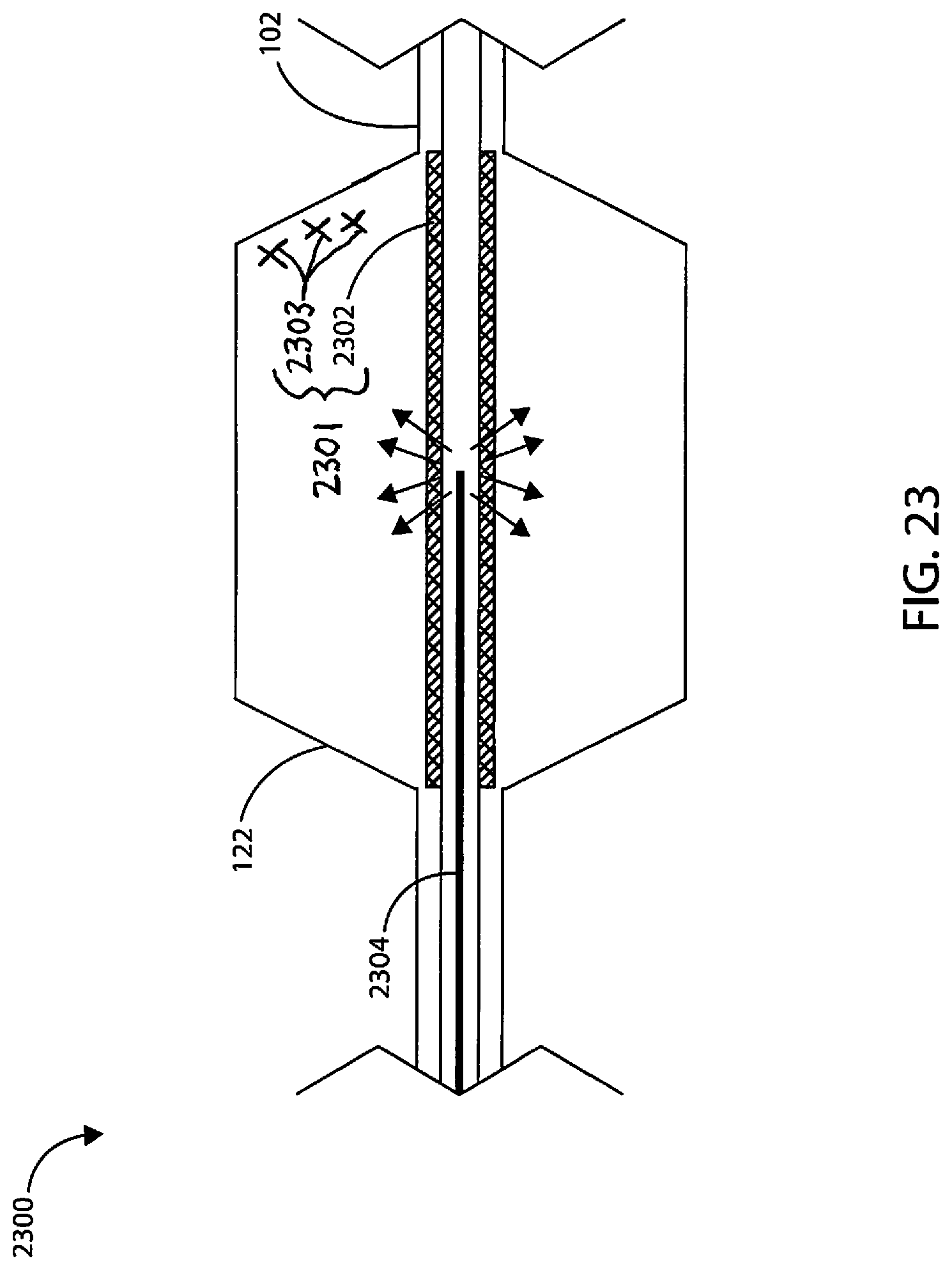 Patent US12311124 Figure 17 – Fortified balloon inflation fluid for plasma system to disrupt vascular lesions