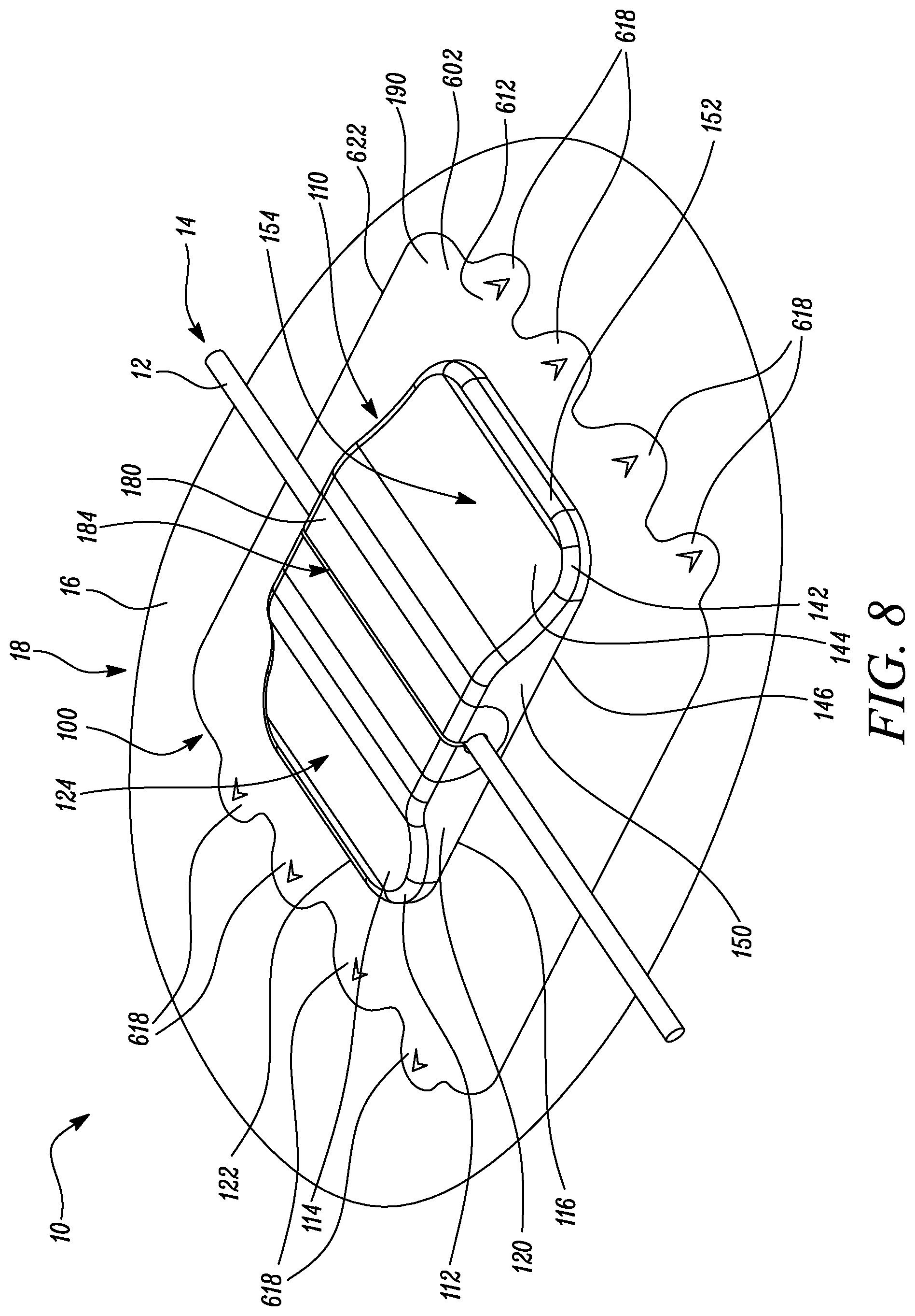 Patent US12311126 Figure 9 – Securement device, kit comprising securement device, and method of securing securement device on skin of user
