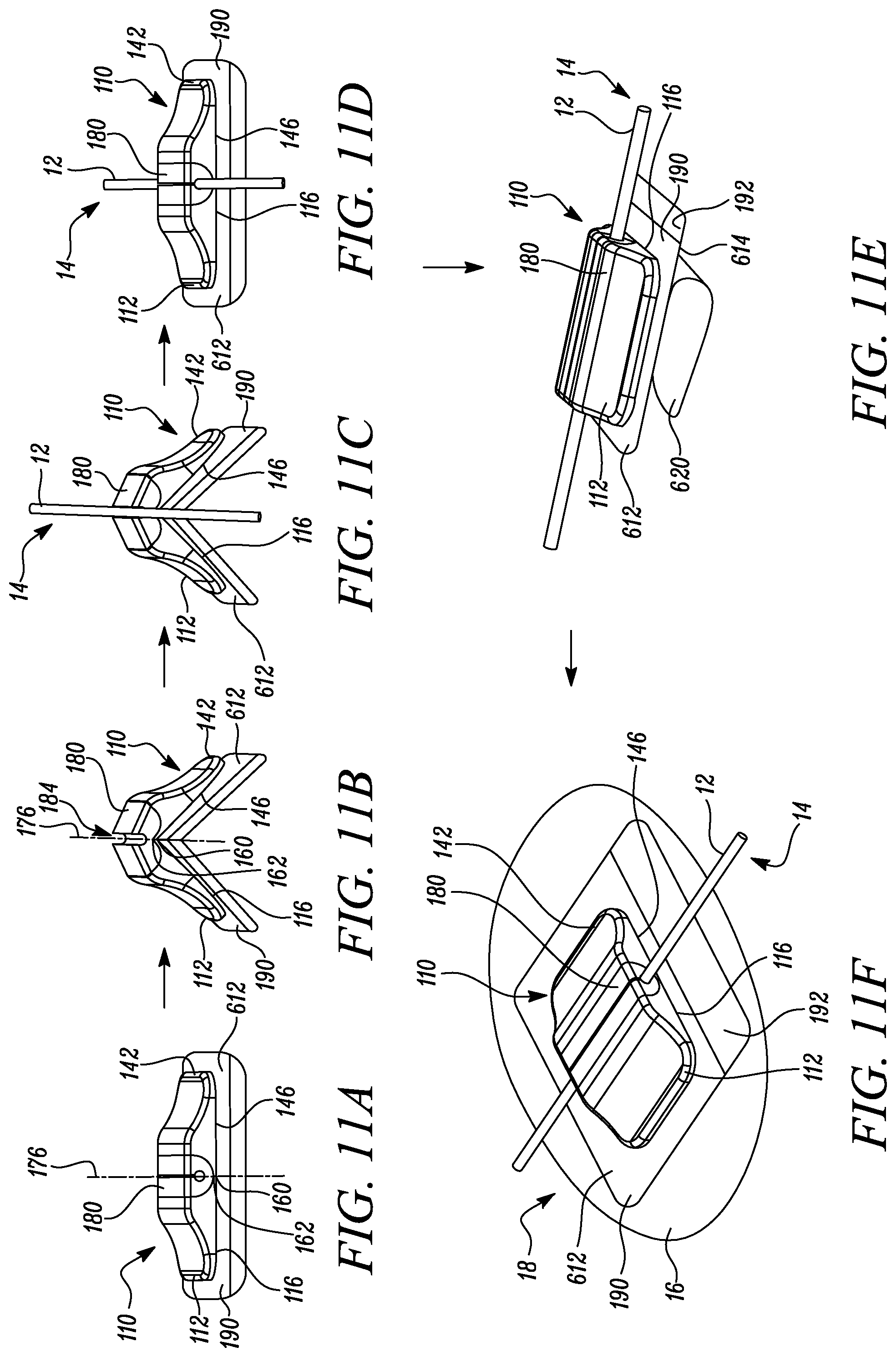 Patent US12311126 Figure 12 – Securement device, kit comprising securement device, and method of securing securement device on skin of user