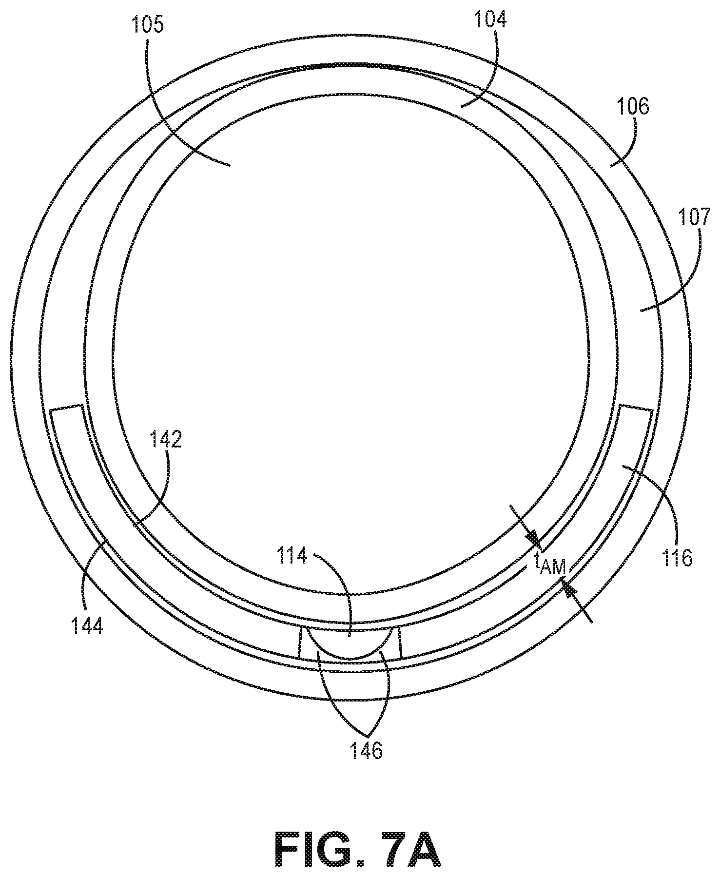 Patent US12311129 Figure 4 – Medical catheter