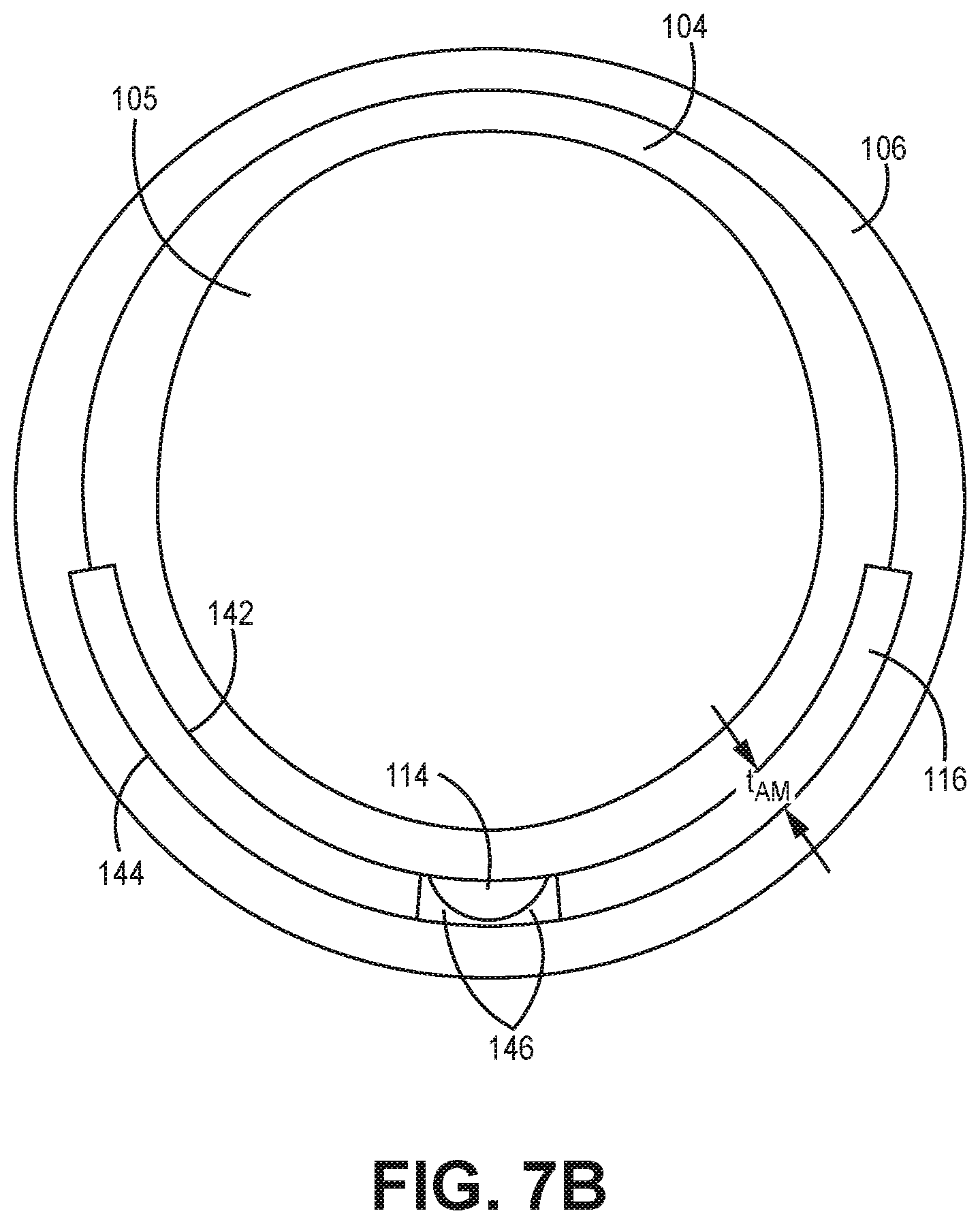 Patent US12311129 Figure 5 – Medical catheter