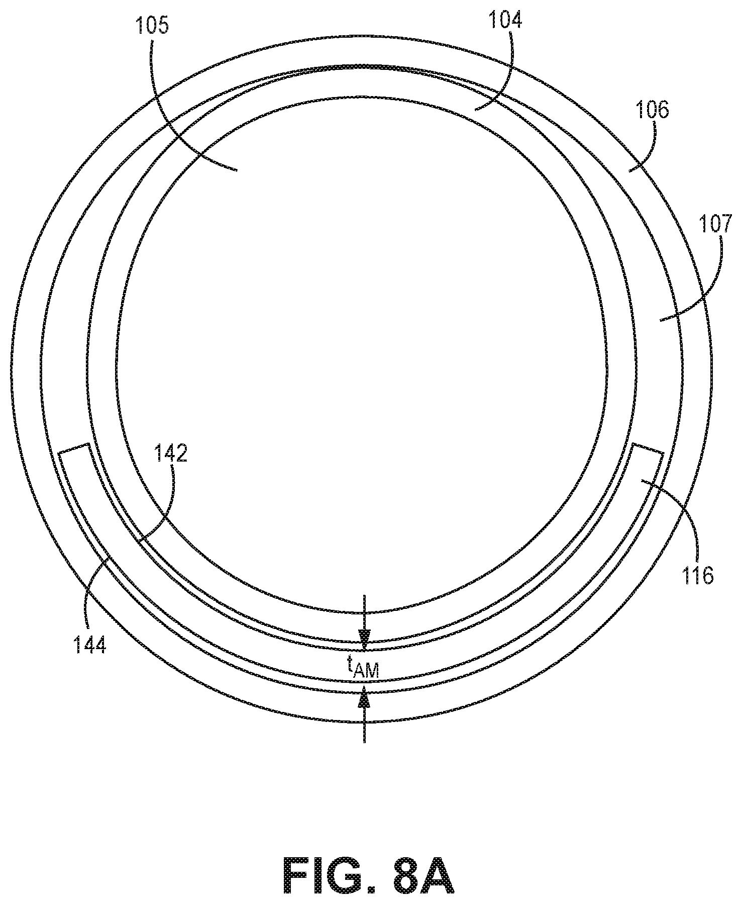 Patent US12311129 Figure 6 – Medical catheter