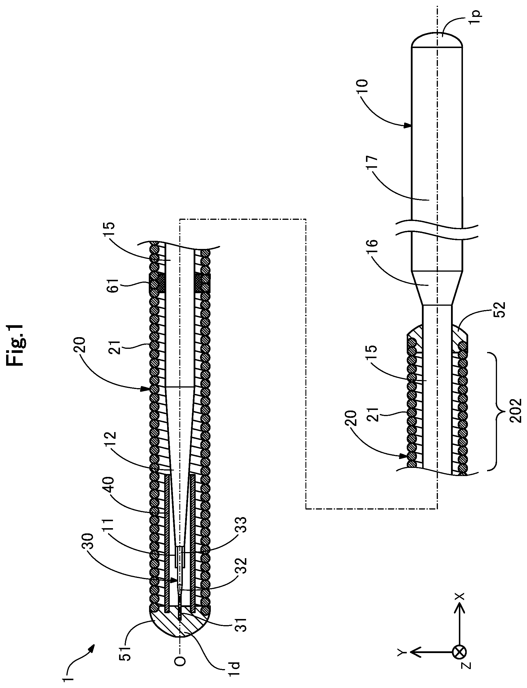 Patent US12311130 Figure 1 – Guide wire
