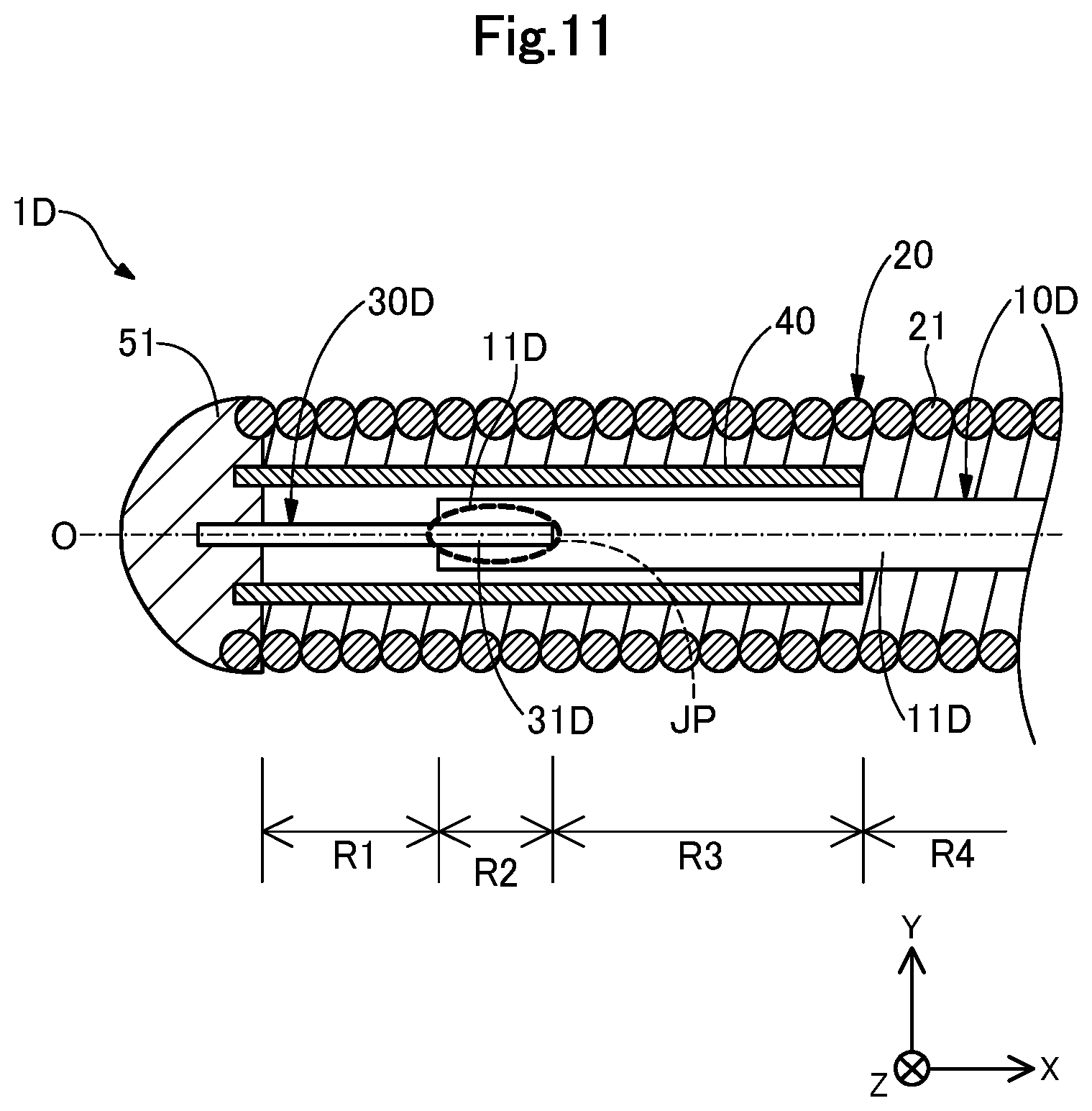 Patent US12311130 Figure 11 – Guide wire