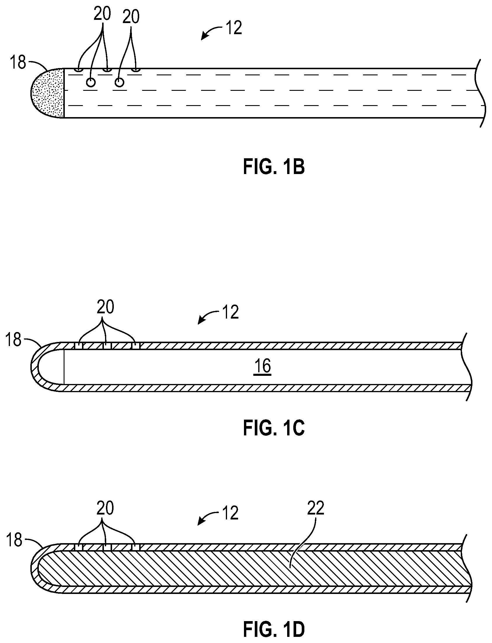 Patent US12311131 Figure 2 – Tubular instrument to reduce vein trauma and related devices and methods