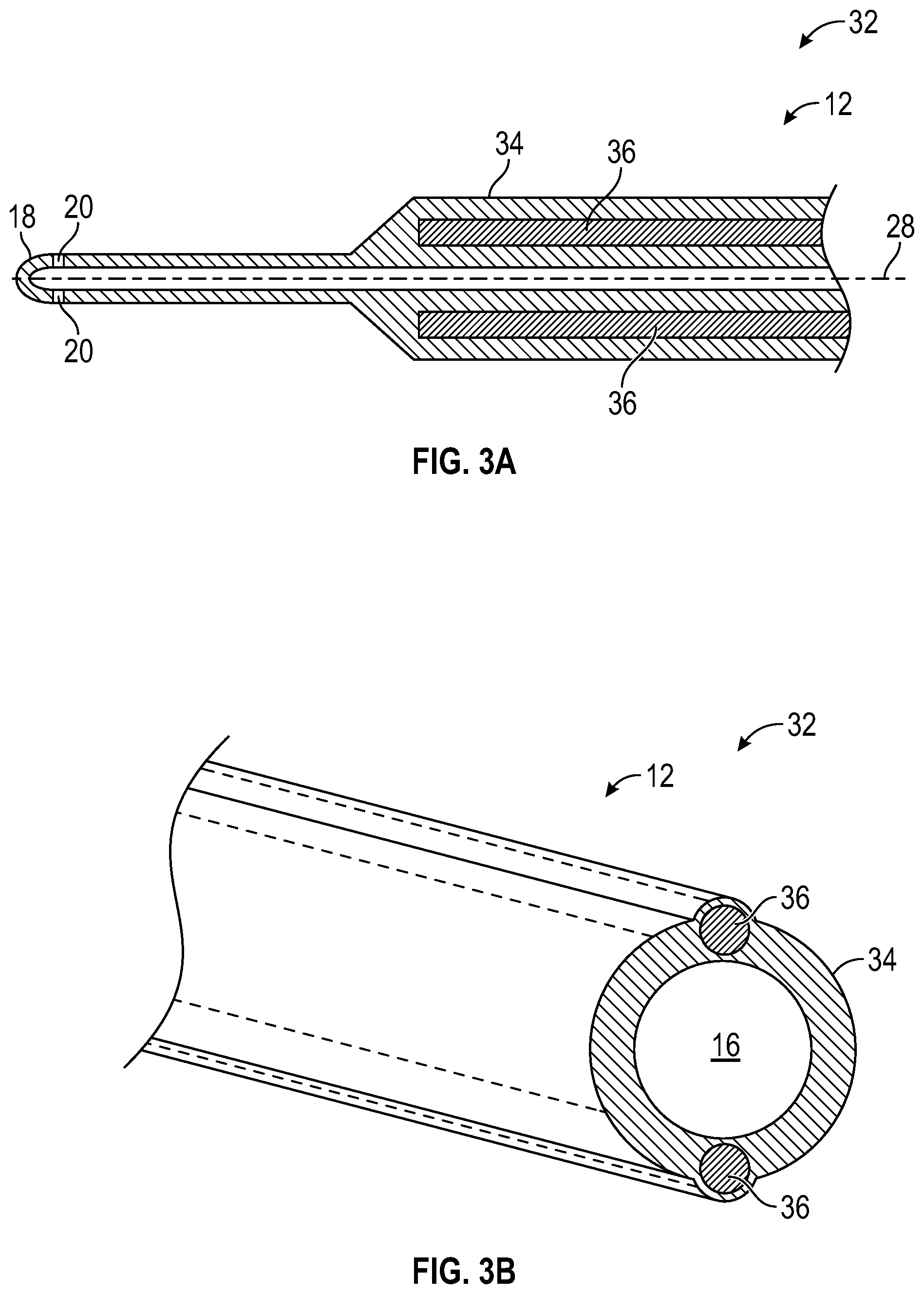 Patent US12311131 Figure 6 – Tubular instrument to reduce vein trauma and related devices and methods