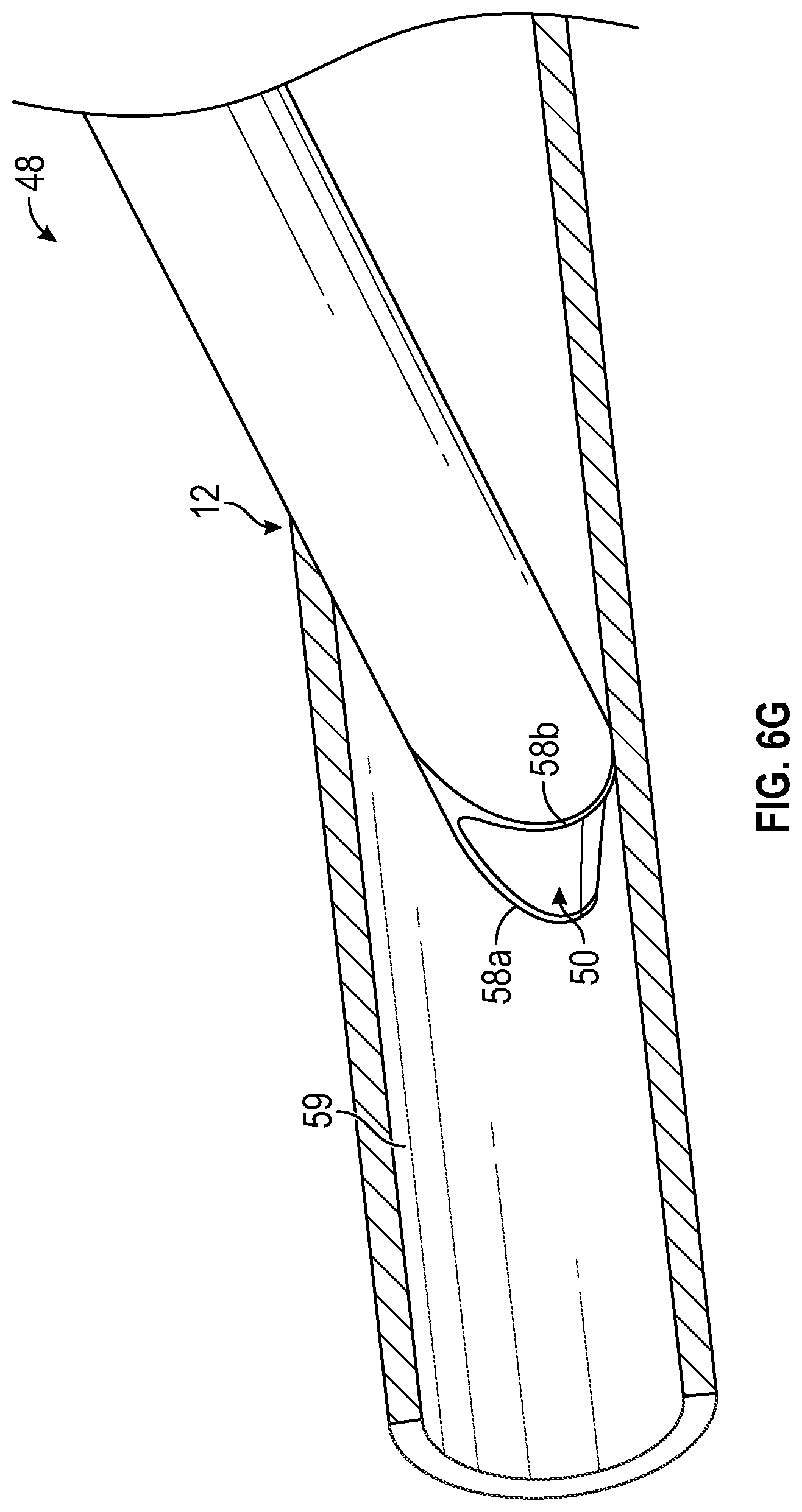 Patent US12311131 Figure 10 – Tubular instrument to reduce vein trauma and related devices and methods