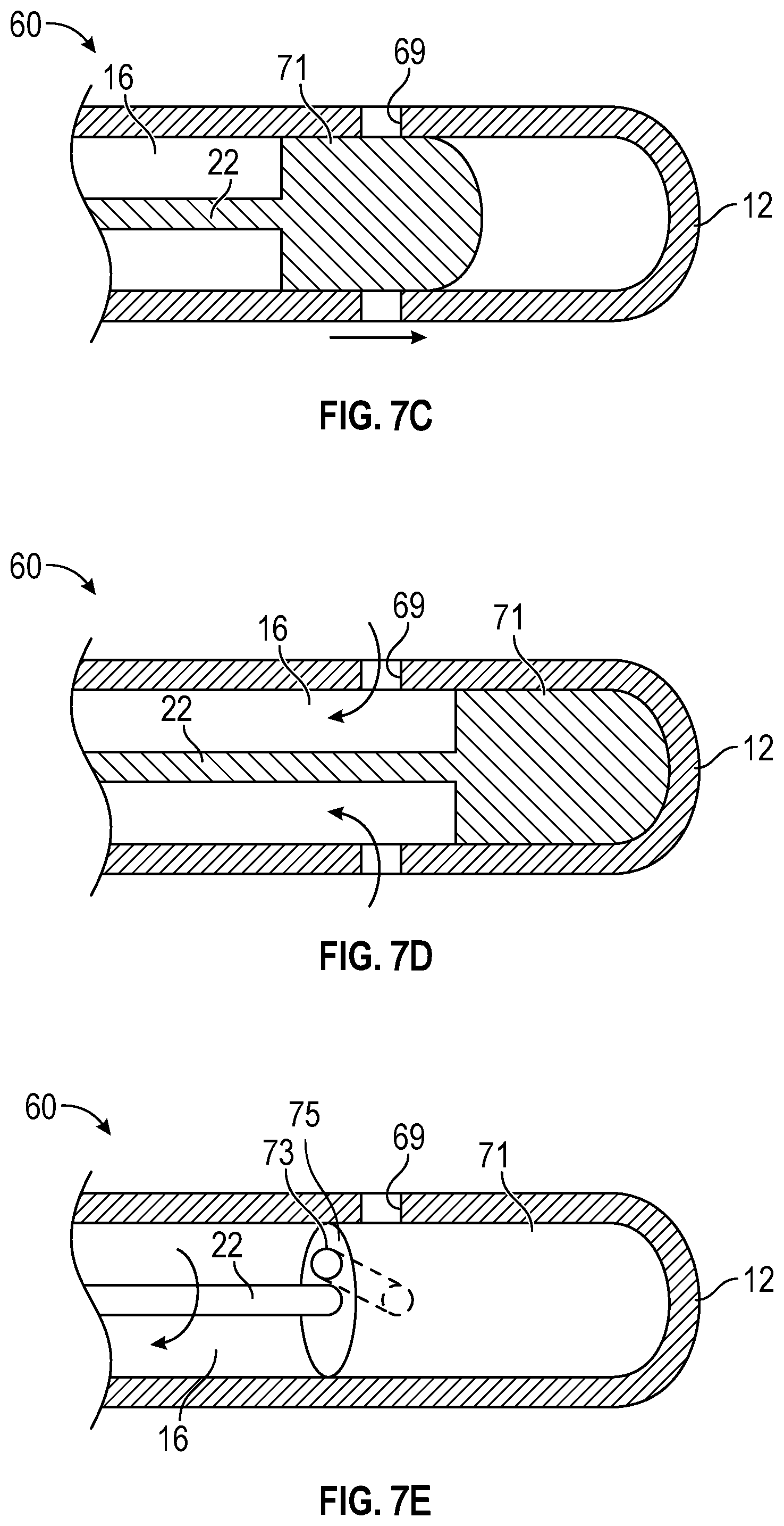 Patent US12311131 Figure 12 – Tubular instrument to reduce vein trauma and related devices and methods