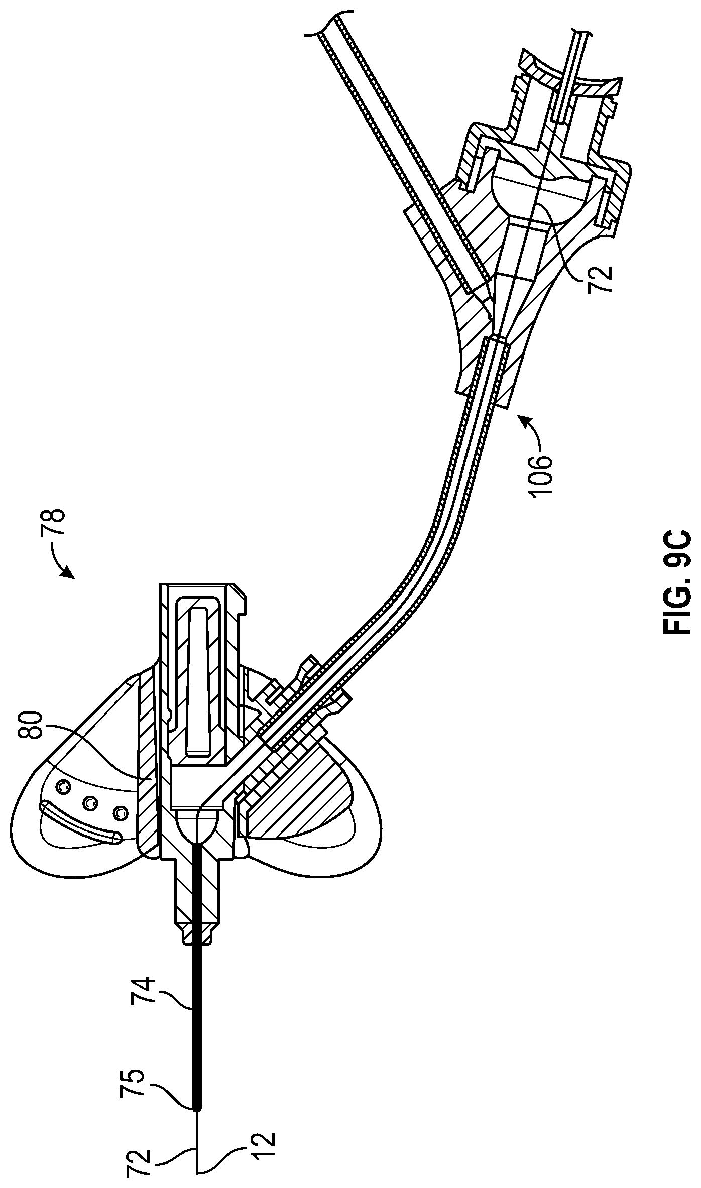 Patent US12311131 Figure 19 – Tubular instrument to reduce vein trauma and related devices and methods