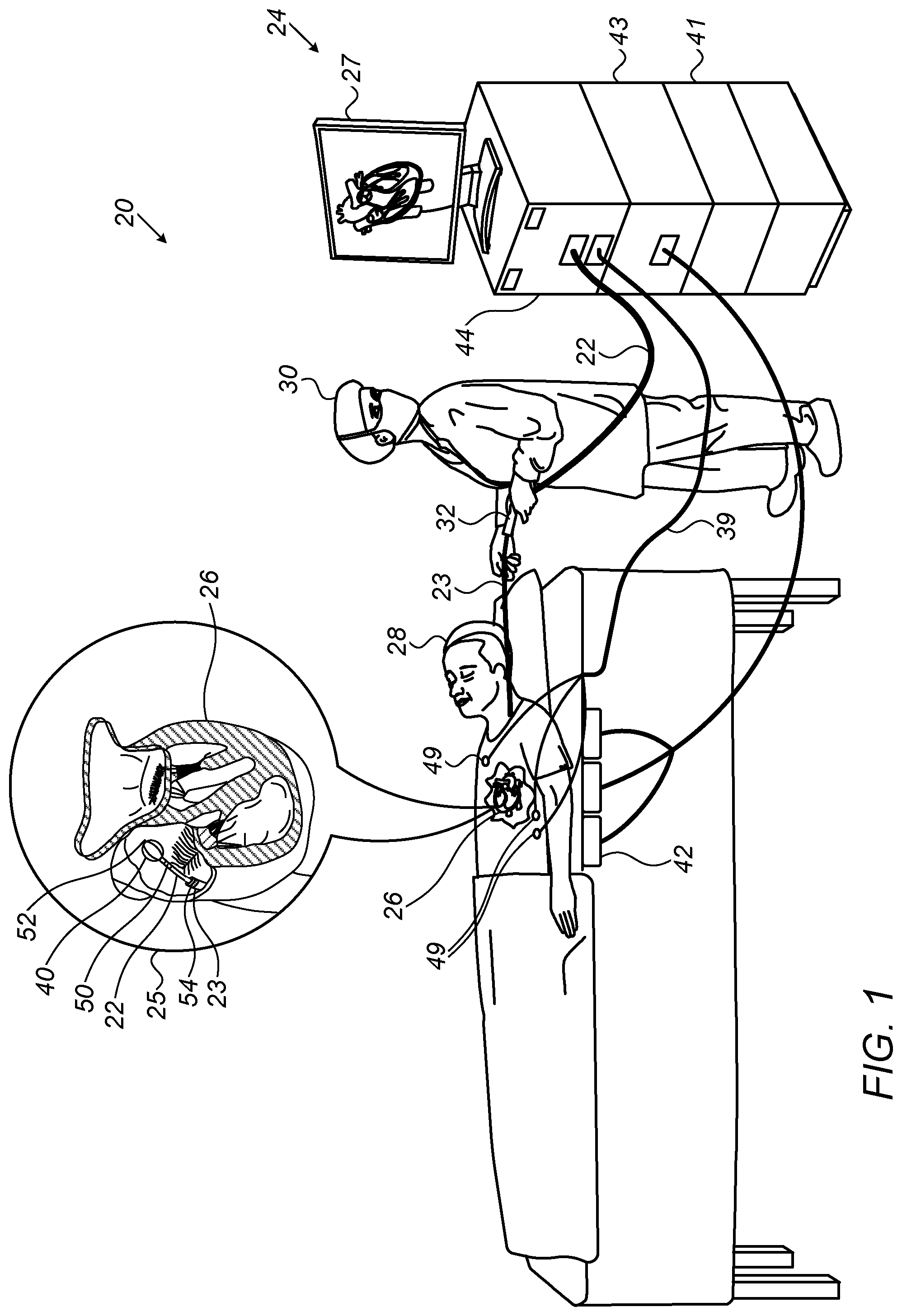 Patent US12311132 Figure 1 – Verifying proper withdrawal of catheter into sheath