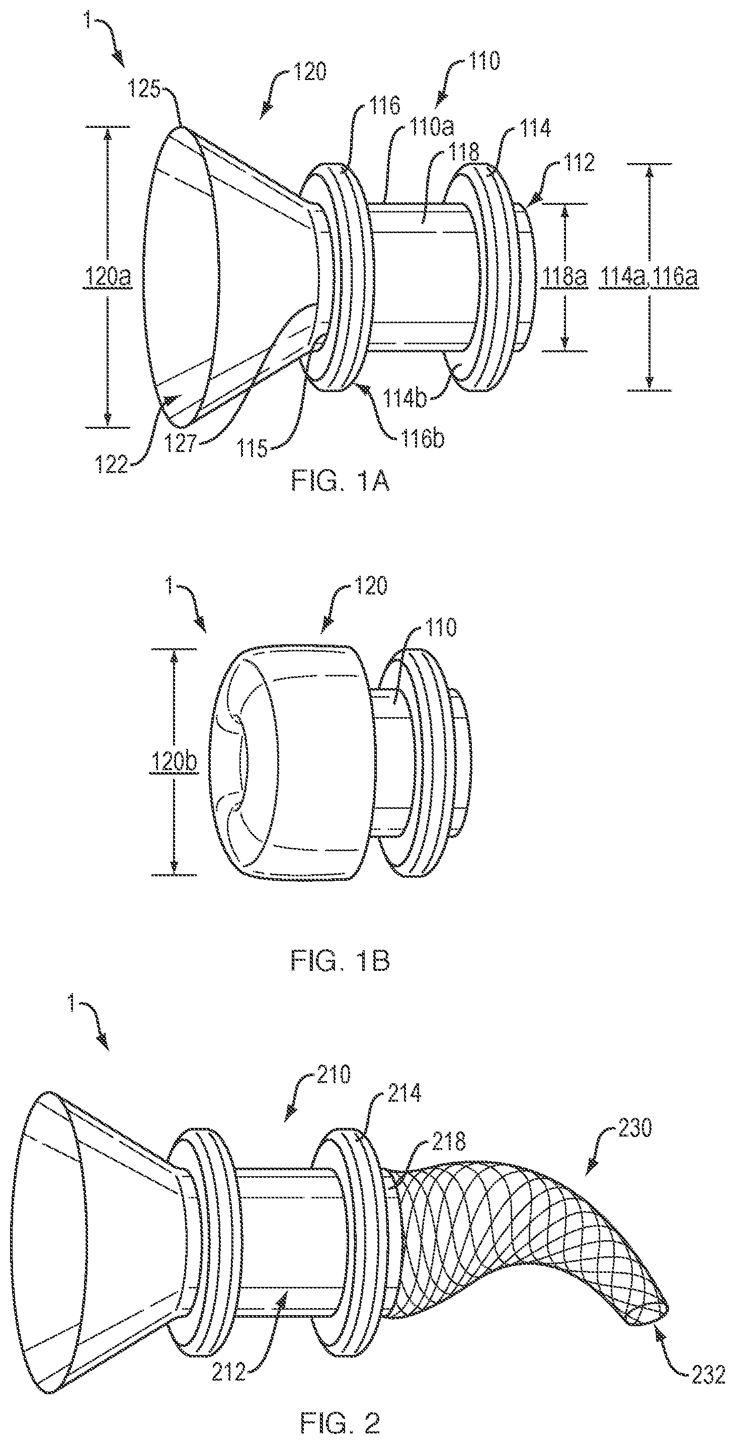 Patent US12311133 Figure 1 – Anastomotic drainage stent