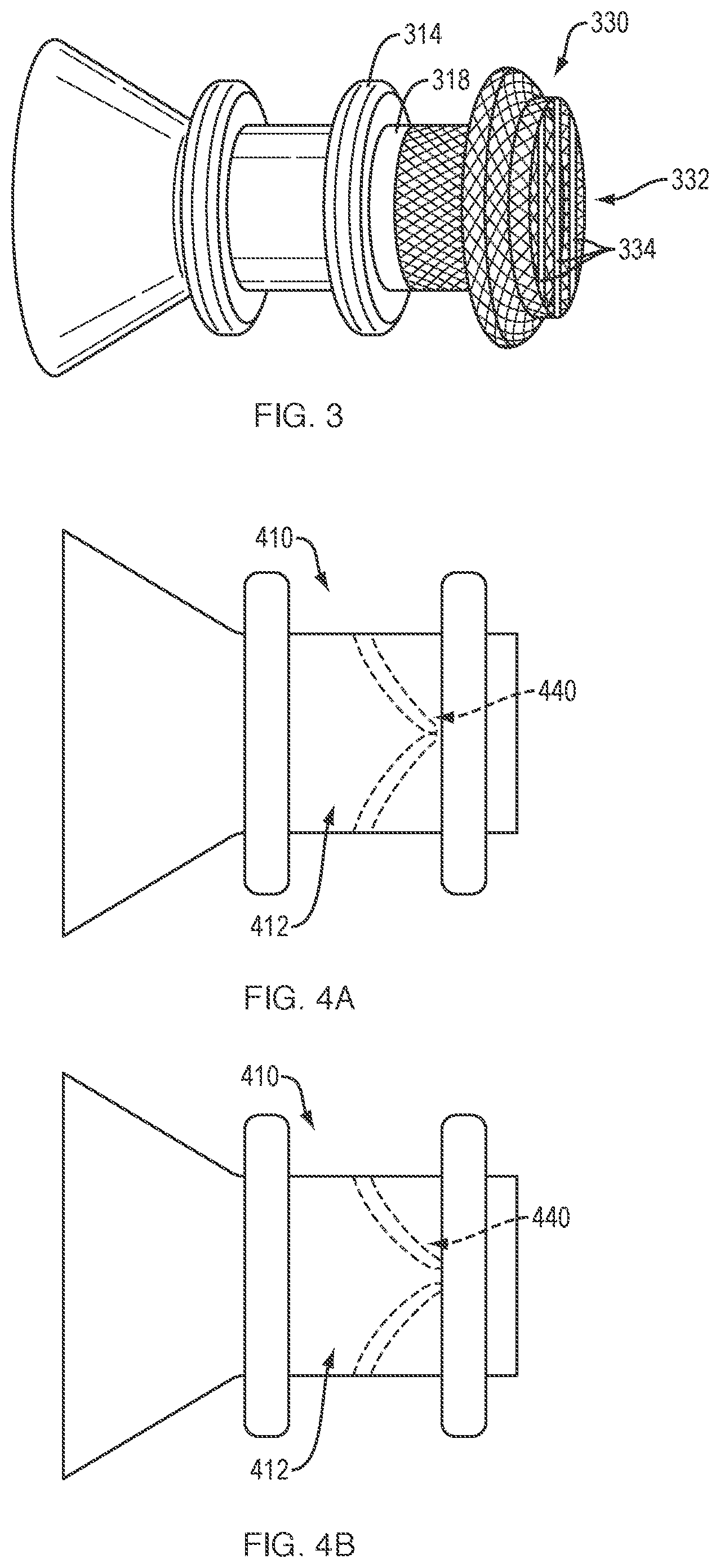Patent US12311133 Figure 2 – Anastomotic drainage stent