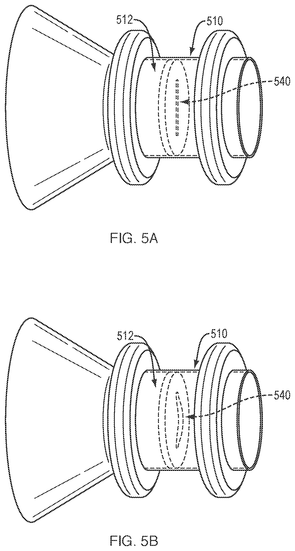 Patent US12311133 Figure 3 – Anastomotic drainage stent