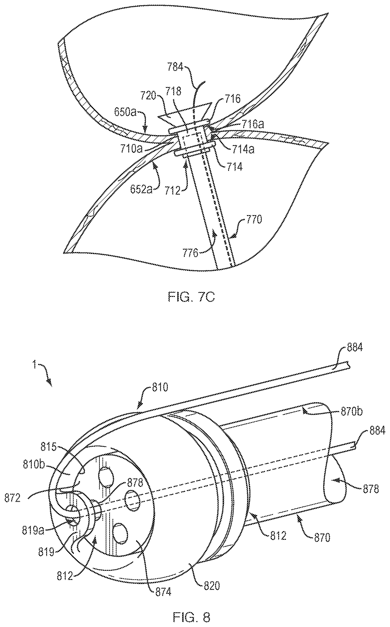 Patent US12311133 Figure 7 – Anastomotic drainage stent