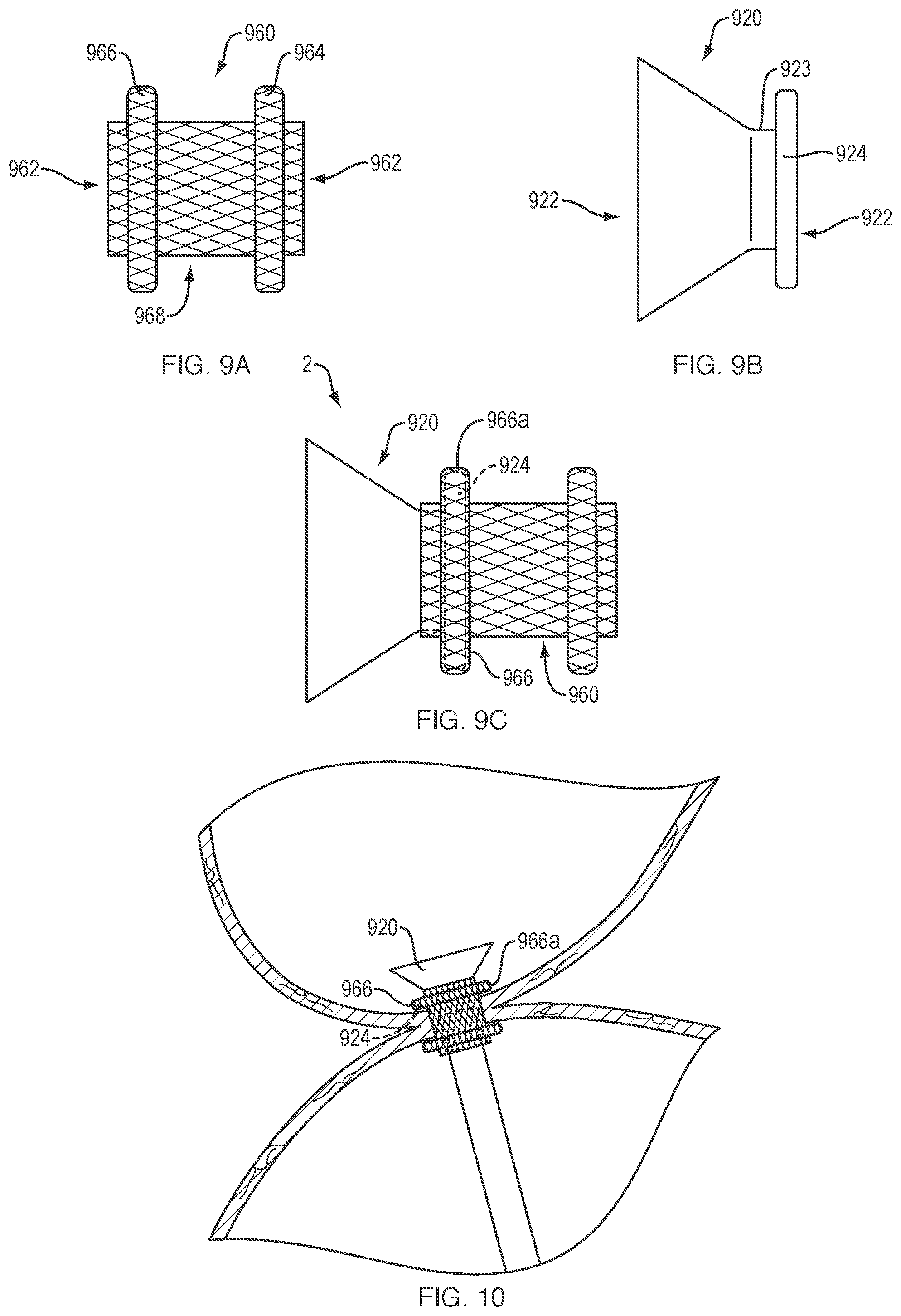 Patent US12311133 Figure 8 – Anastomotic drainage stent