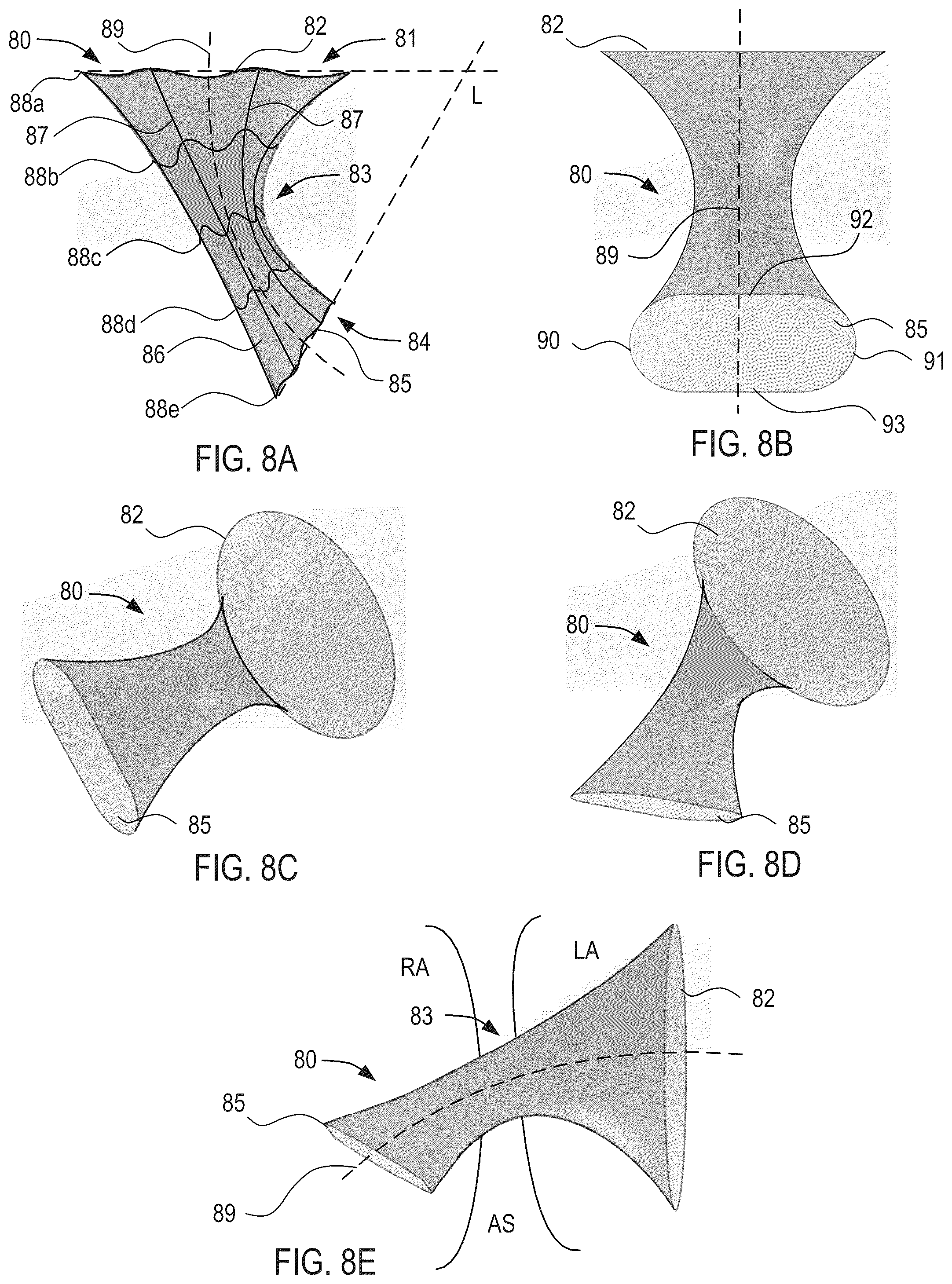 Patent US12311134 Figure 7 – Asymmetric shunt for redistributing atrial blood volume