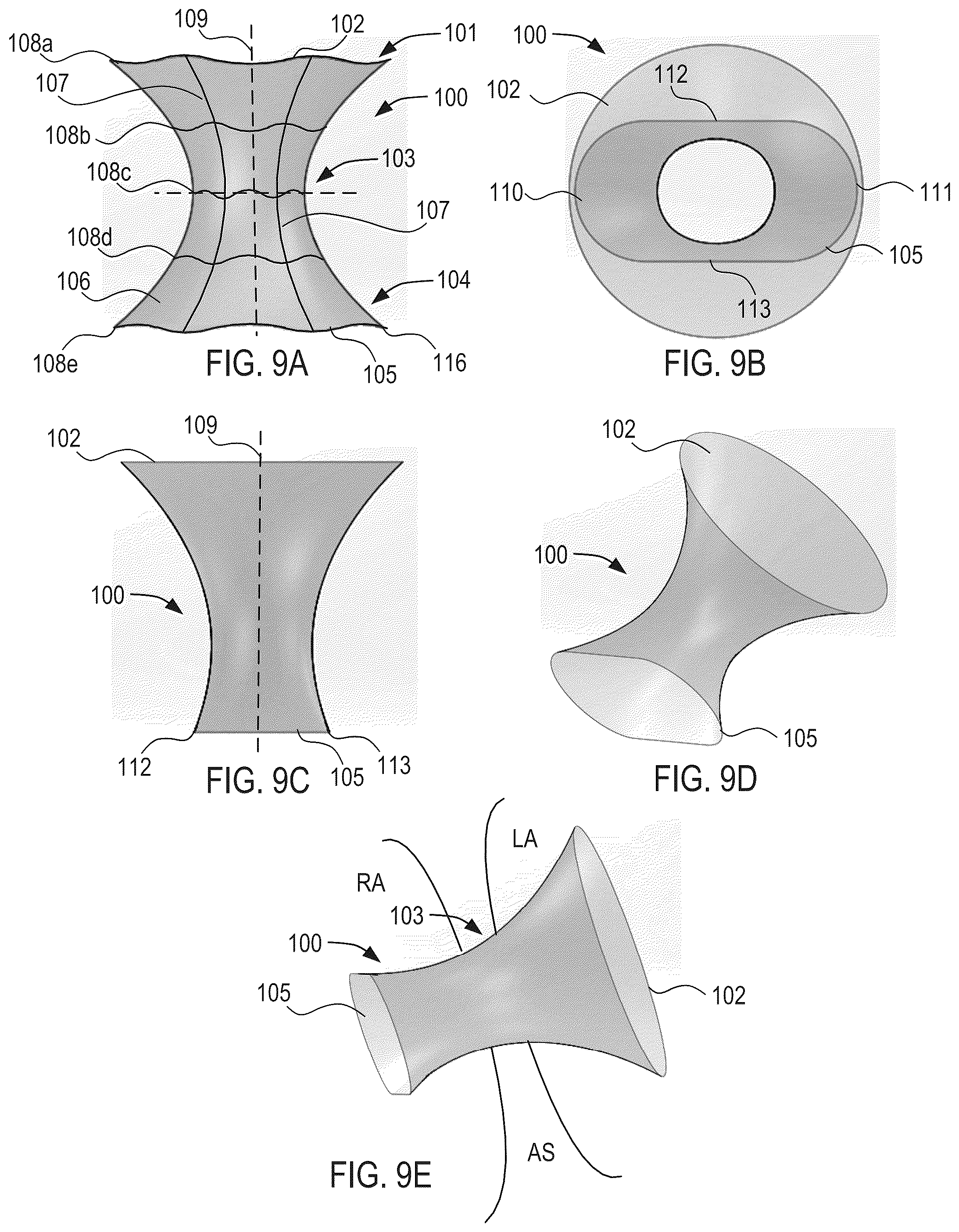 Patent US12311134 Figure 8 – Asymmetric shunt for redistributing atrial blood volume