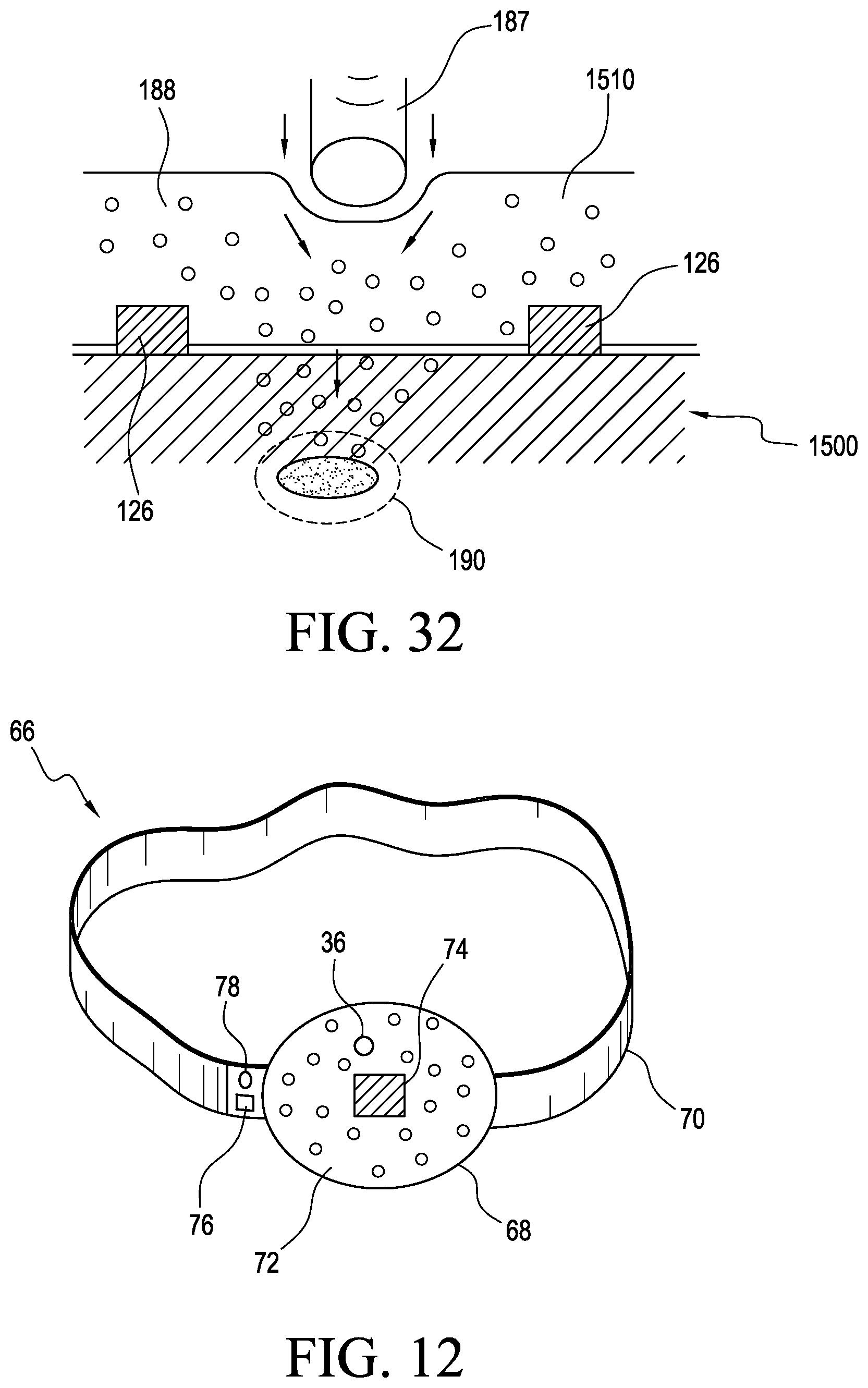 Patent US12311135 Figure 7 – Apparatus and method for skin treatment