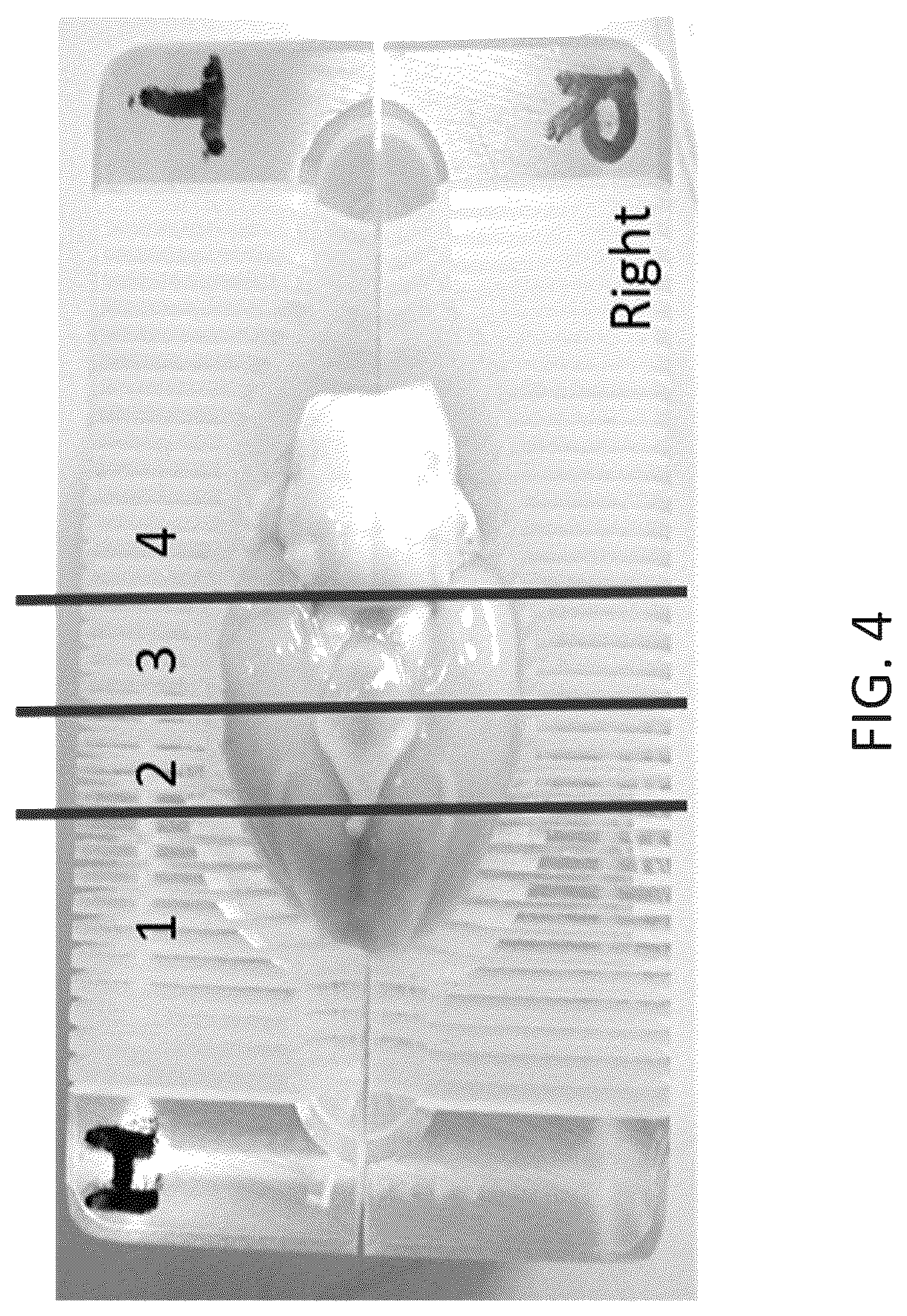 Patent US12311136 Figure 4 – Using alternating electric fields to increase permeability of the blood brain barrier