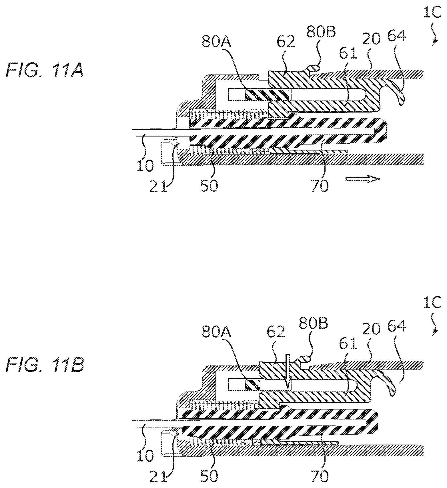Patent US12311154 Figure 11 – Medical needle