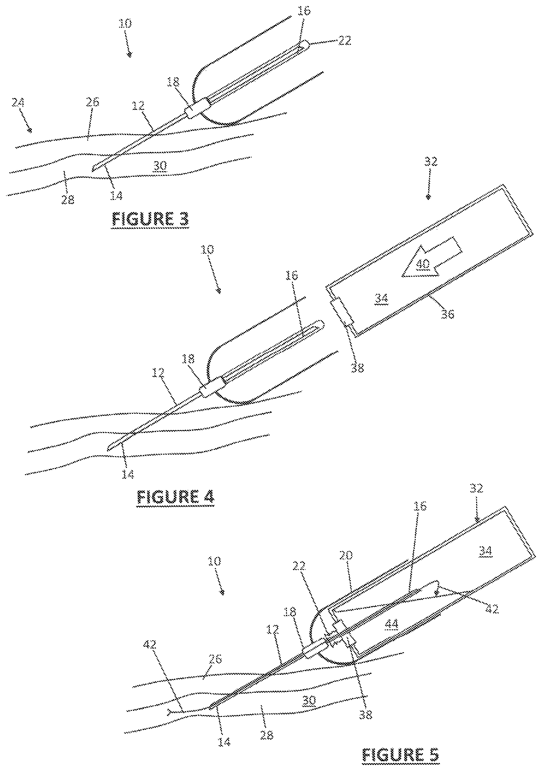 Patent US12311156 Figure 2 – Phlebotomy needle destruction