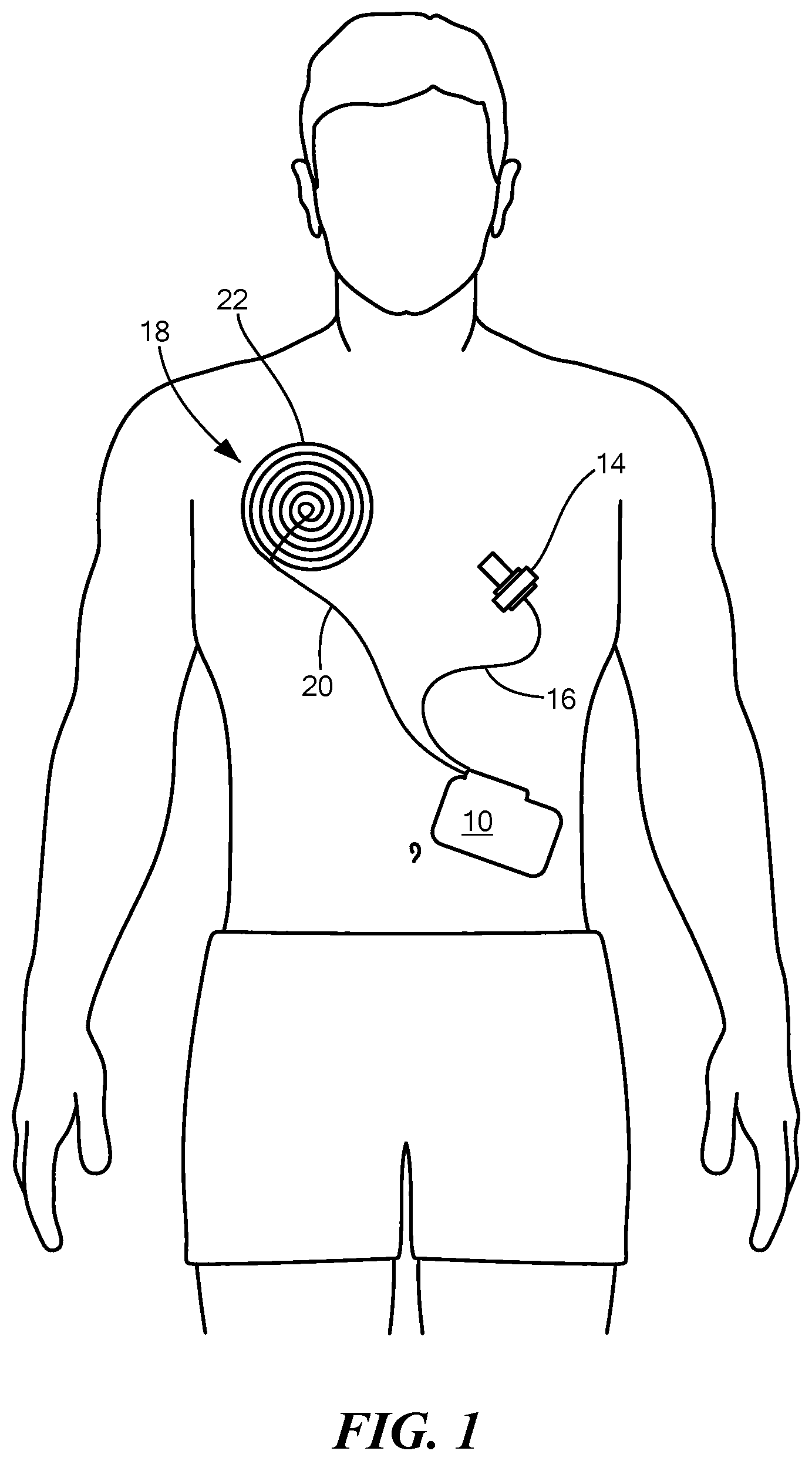 Patent US12311162 Figure 1 – Header/connector thermal spreader