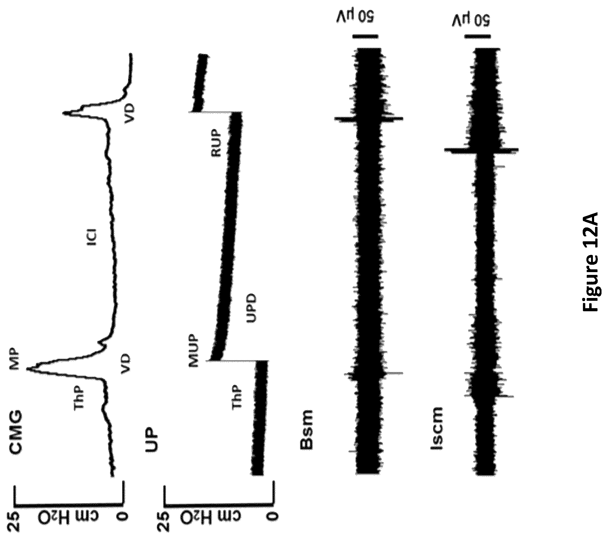 Patent US12311164 Figure 17 – Devices and methods for neuromodulation