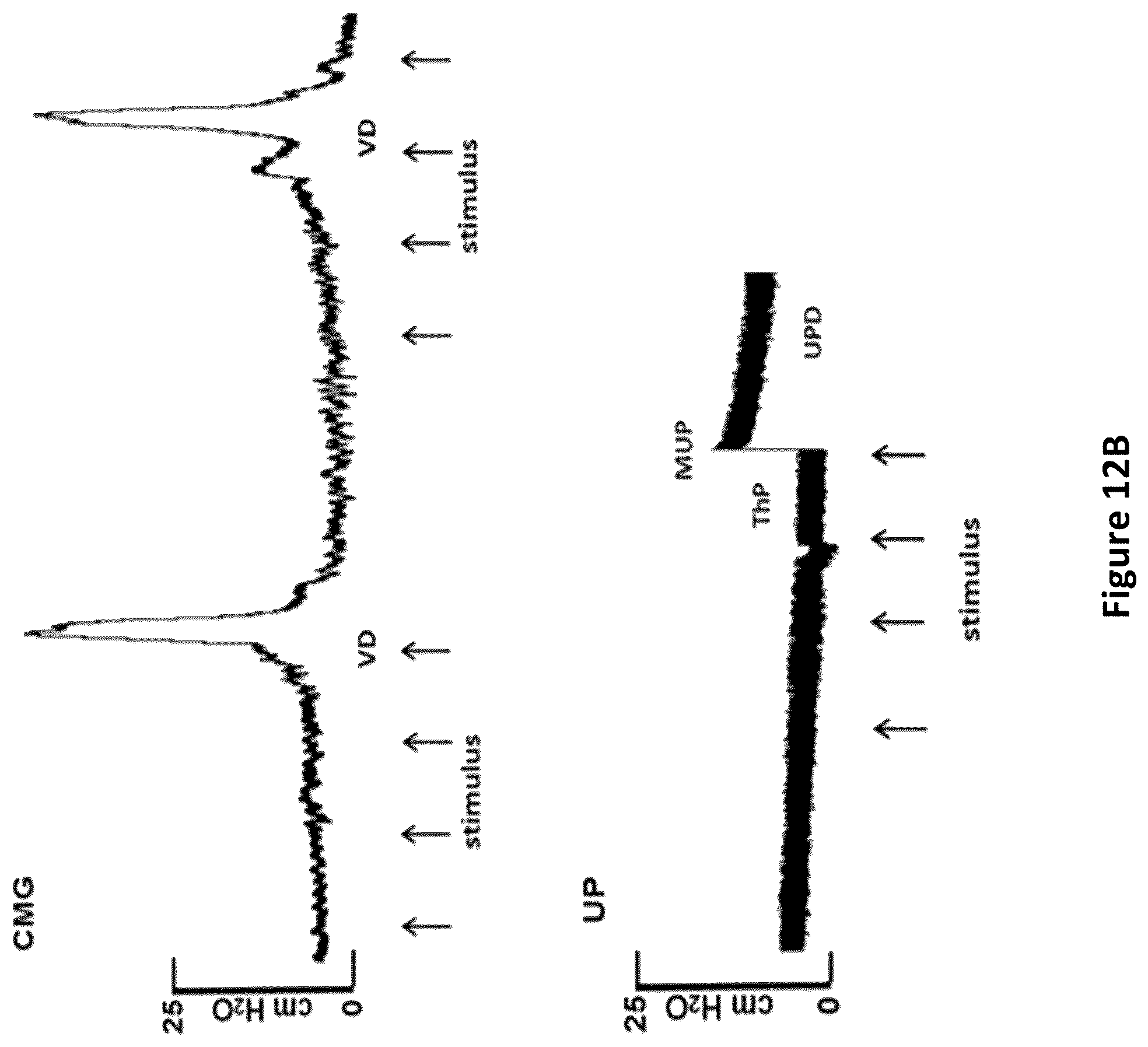 Patent US12311164 Figure 18 – Devices and methods for neuromodulation