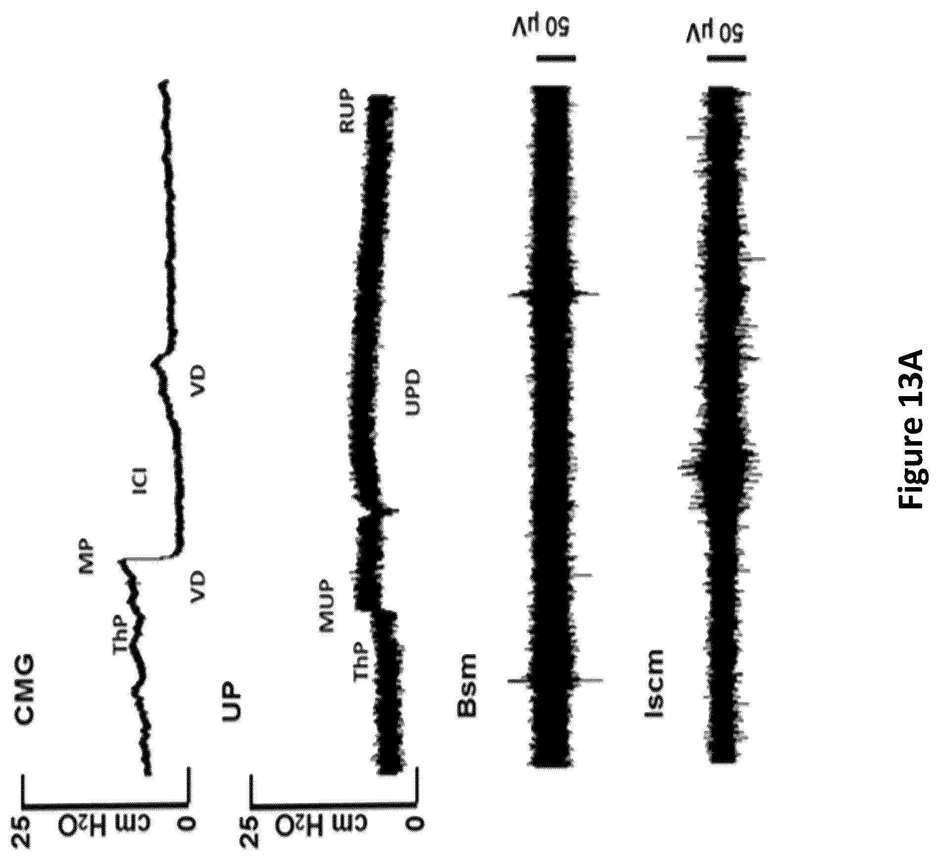 Patent US12311164 Figure 19 – Devices and methods for neuromodulation