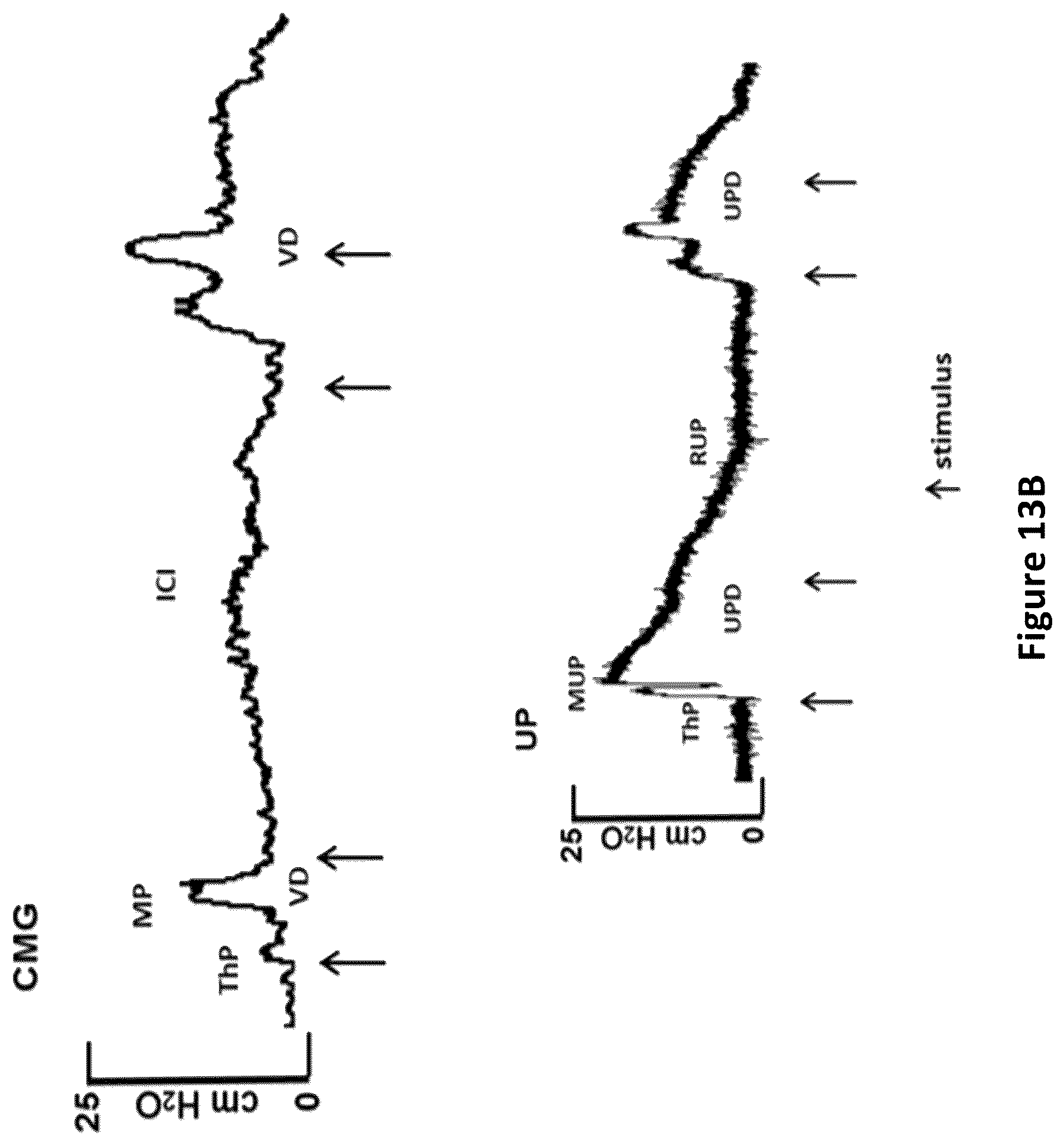 Patent US12311164 Figure 20 – Devices and methods for neuromodulation