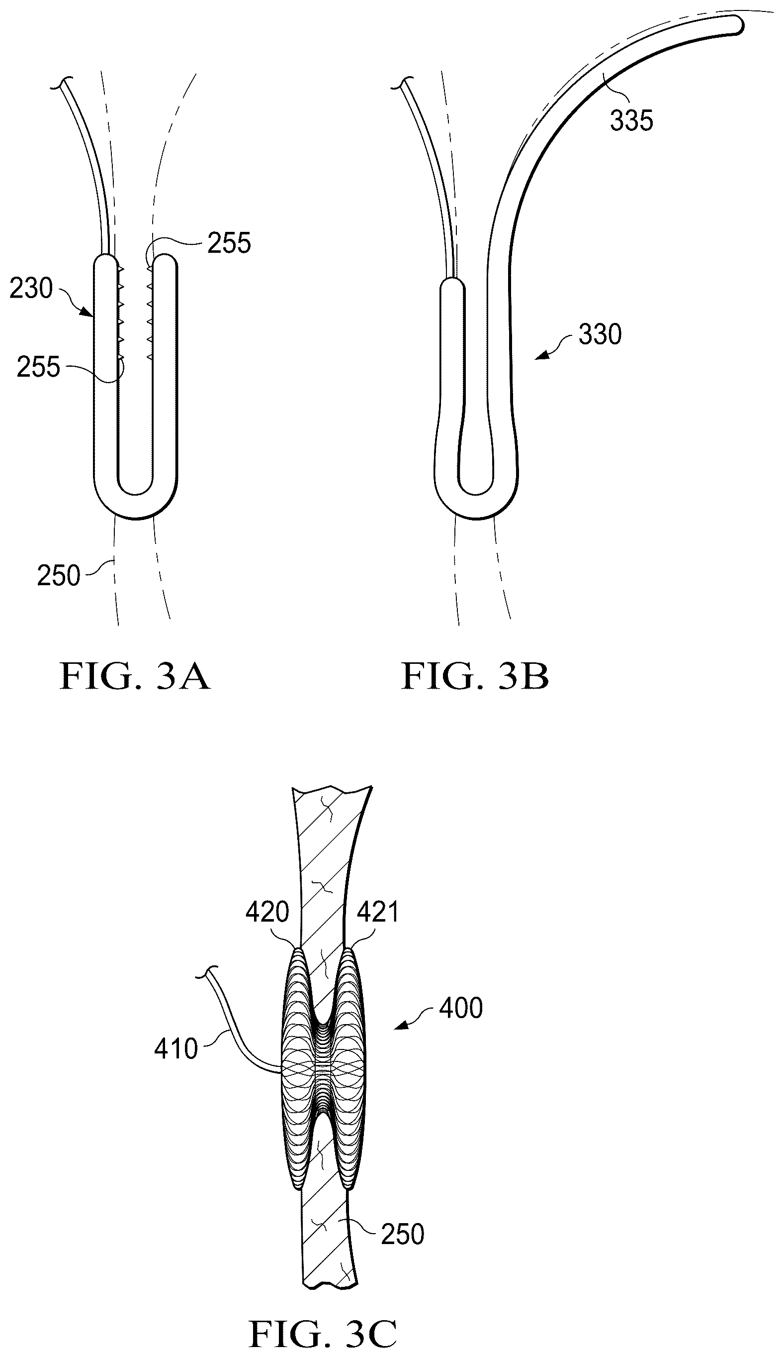 Patent US12311165 Figure 10 – Implantable endovascular, low profile intracardiac left atrial restraining devices for low energy atrial cardioversion, pacing and sensing