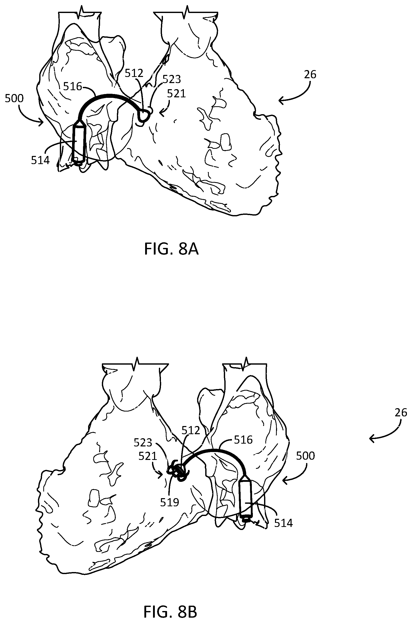 Patent US12311166 Figure 8 – Implantable medical system