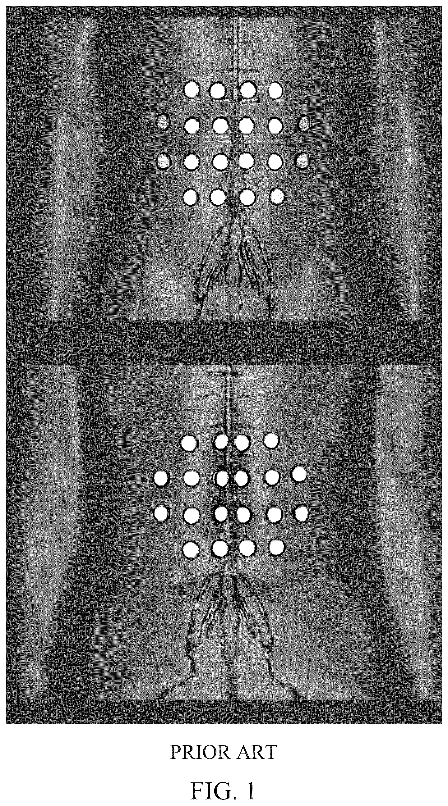 Patent US12311167 Figure 1 – Delivering alternating electric fields (e.g., TTFields) to a subject's spinal anatomy