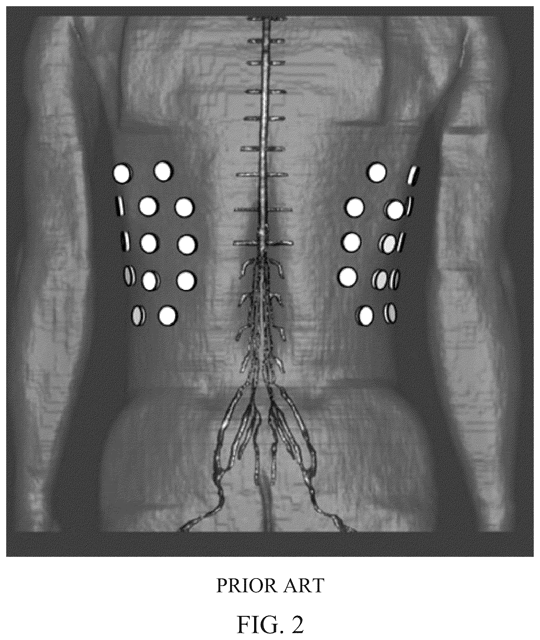 Patent US12311167 Figure 2 – Delivering alternating electric fields (e.g., TTFields) to a subject's spinal anatomy