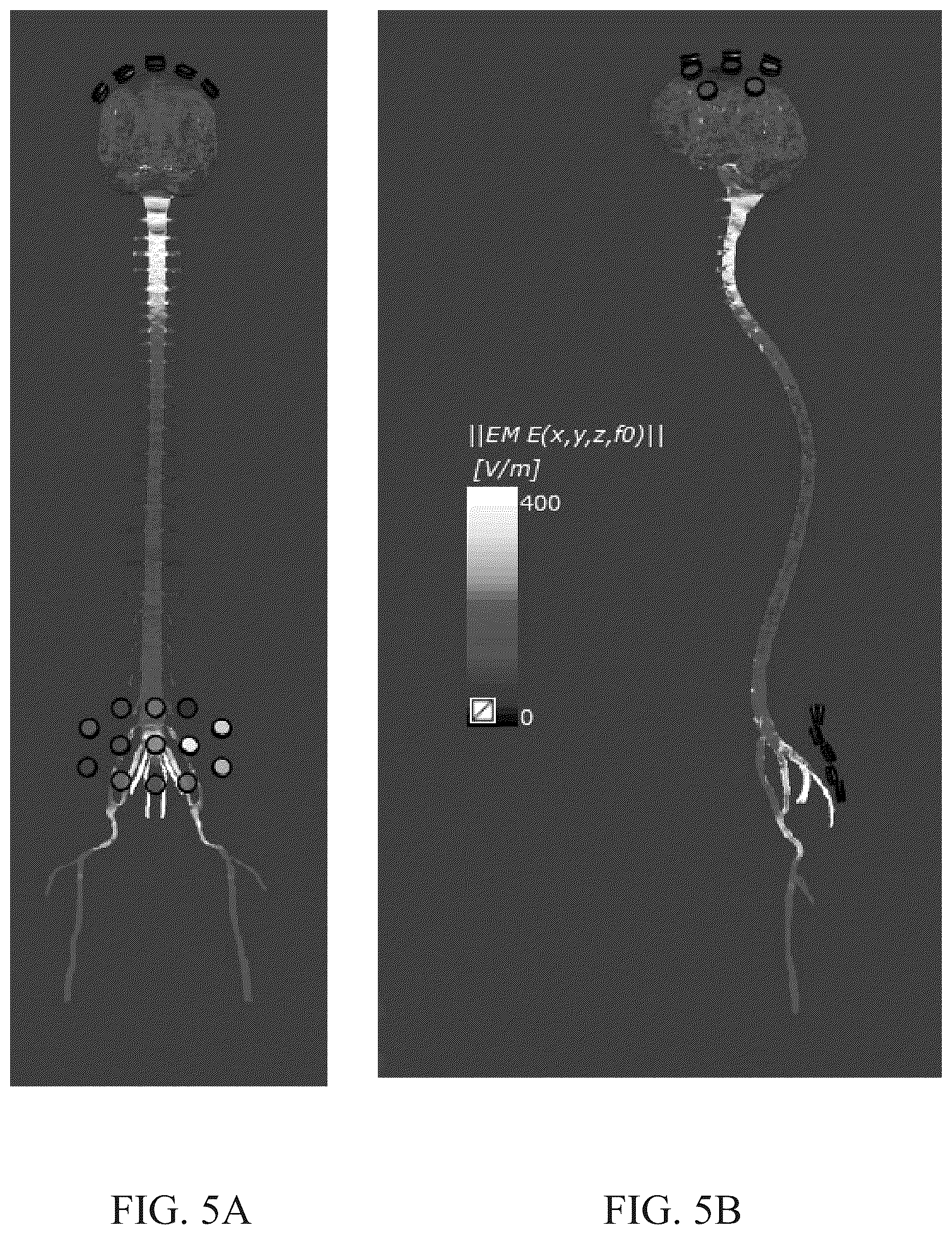 Patent US12311167 Figure 5 – Delivering alternating electric fields (e.g., TTFields) to a subject's spinal anatomy