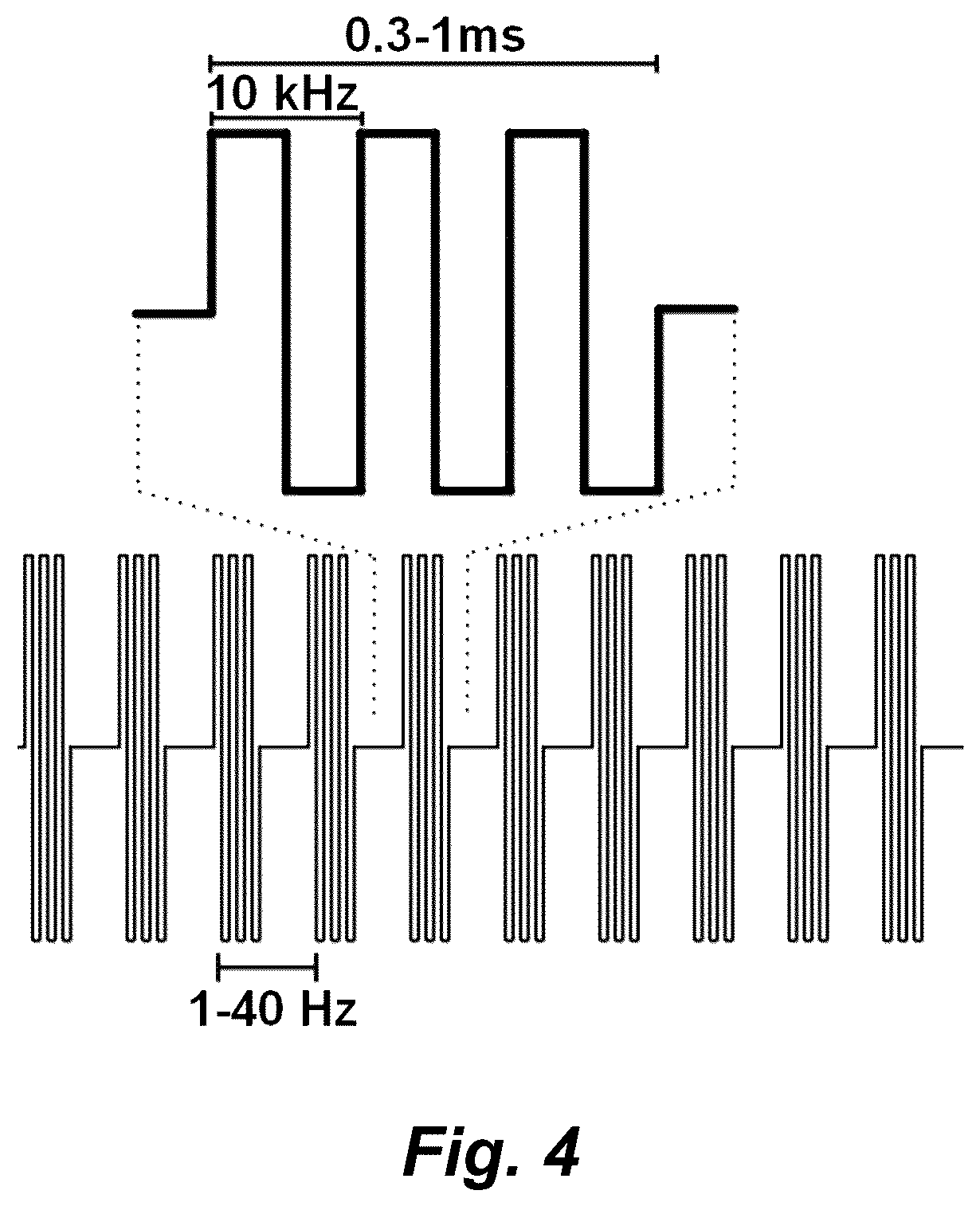 Patent US12311169 Figure 4 – Multi-site transcutaneous electrical stimulation of the spinal cord for facilitation of locomotion