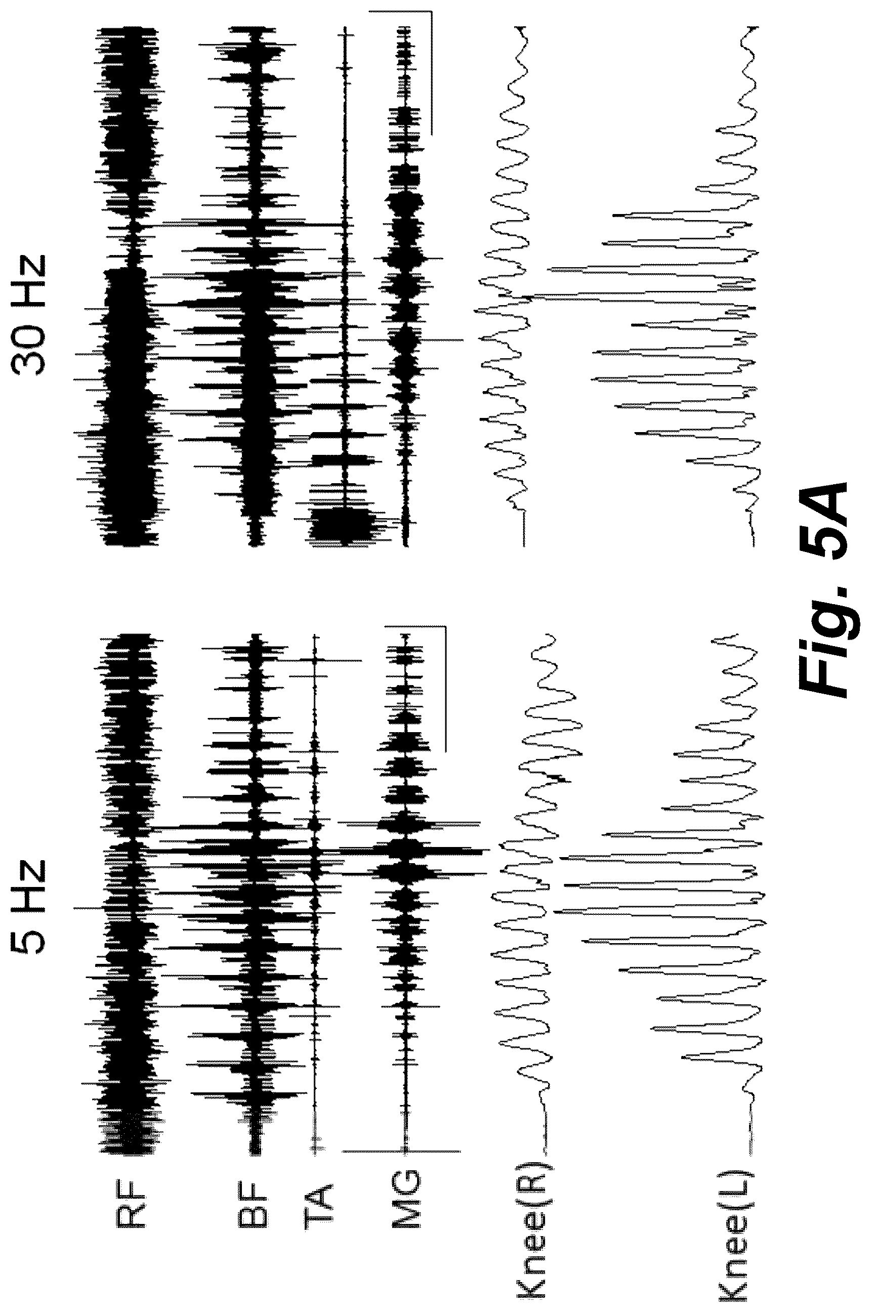 Patent US12311169 Figure 5 – Multi-site transcutaneous electrical stimulation of the spinal cord for facilitation of locomotion