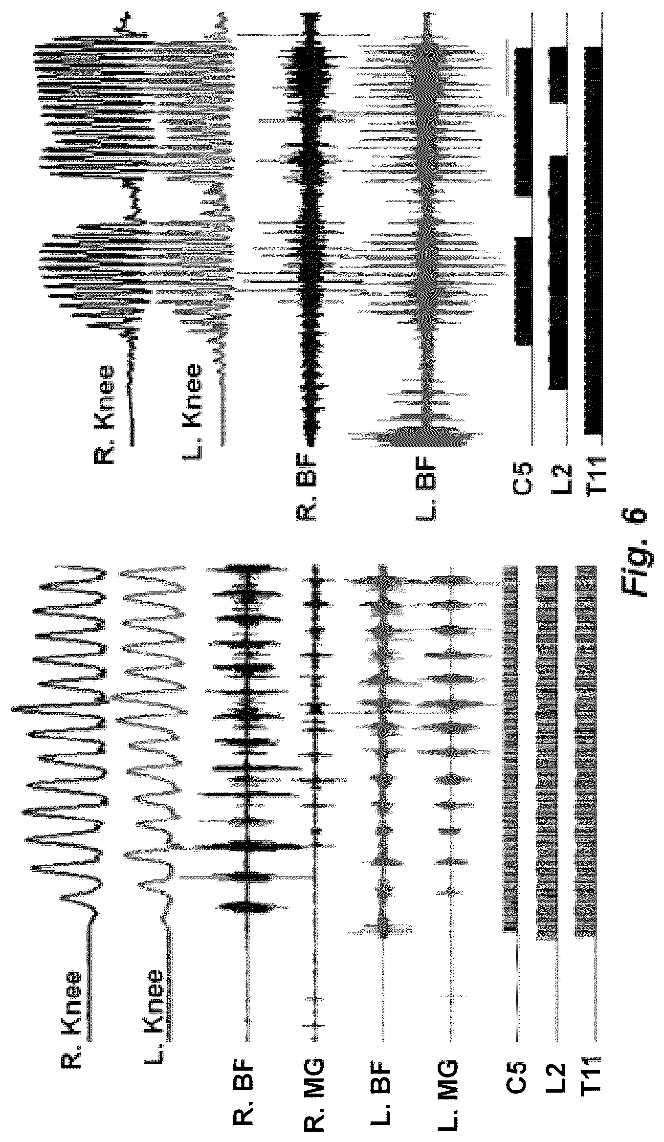 Patent US12311169 Figure 7 – Multi-site transcutaneous electrical stimulation of the spinal cord for facilitation of locomotion