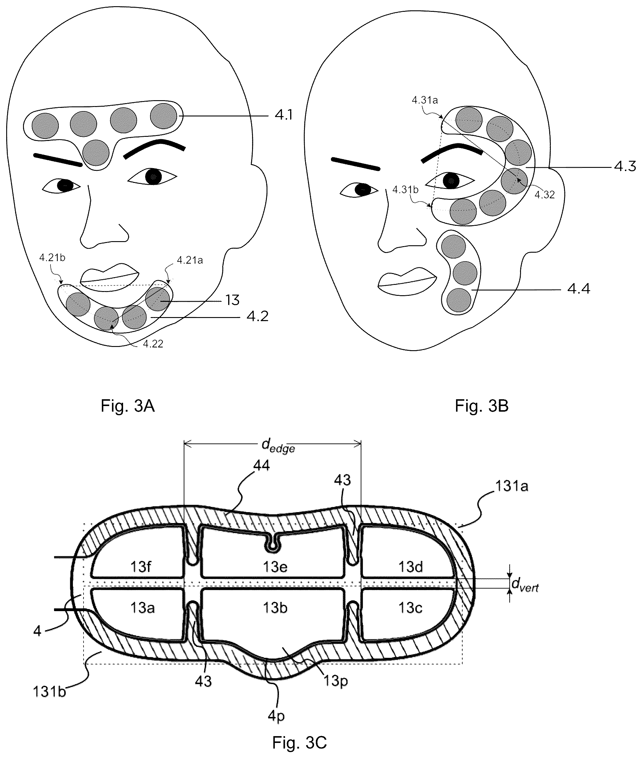 Patent US12311170 Figure 3 – Device and method for unattended treatment of a patient