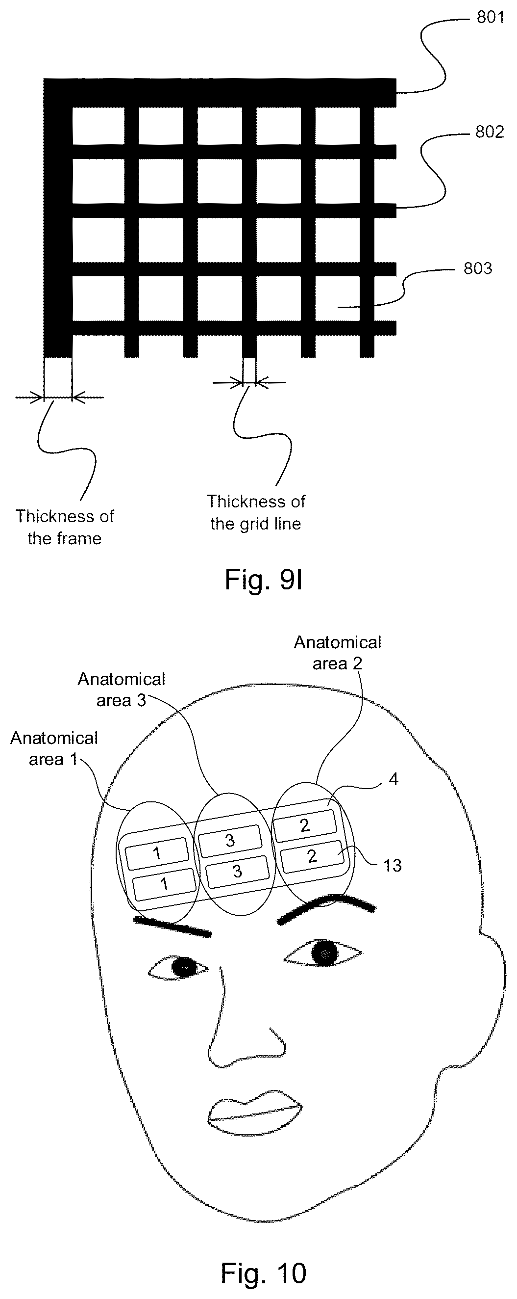 Patent US12311170 Figure 12 – Device and method for unattended treatment of a patient